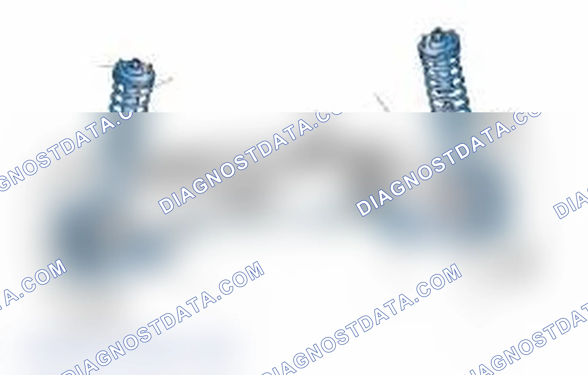 Scheme 25: Typical Front Suspension & Steering Components