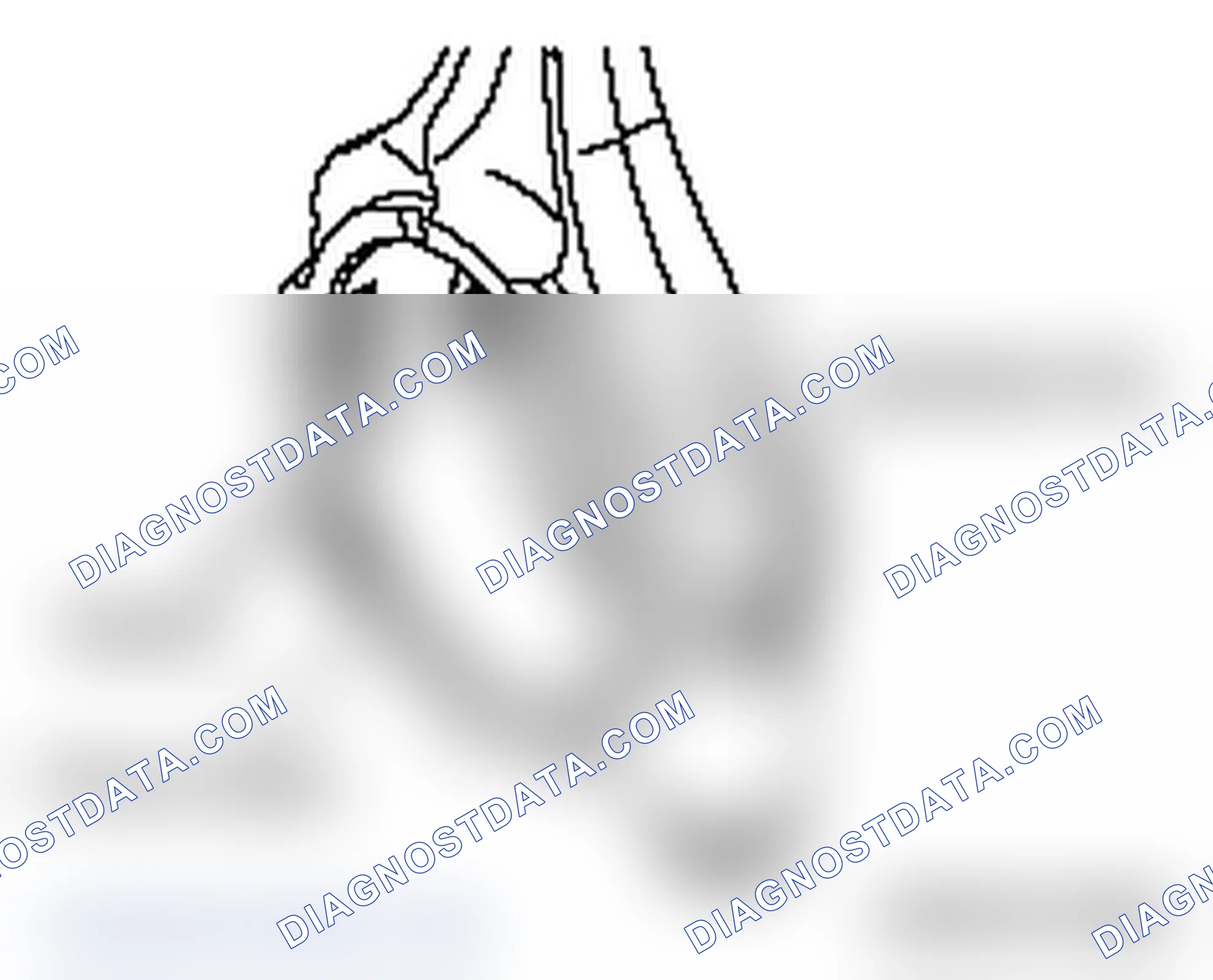 Scheme 807: >> F << CONNECTING ROD CAP INSTALLATION