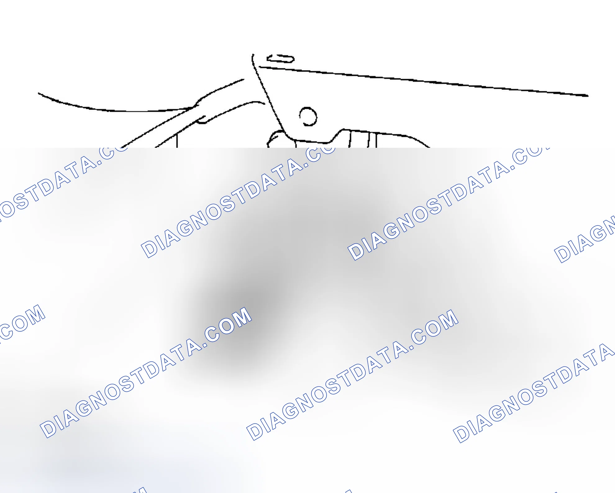Scheme 4: Removing Service Plug