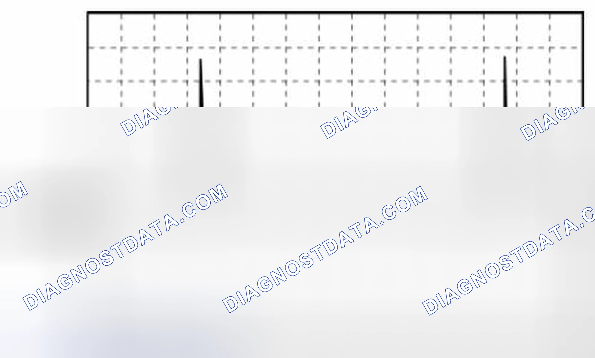 Scheme 201: High Pressure Fuel Pump Control (-) Signal Waveform Graph