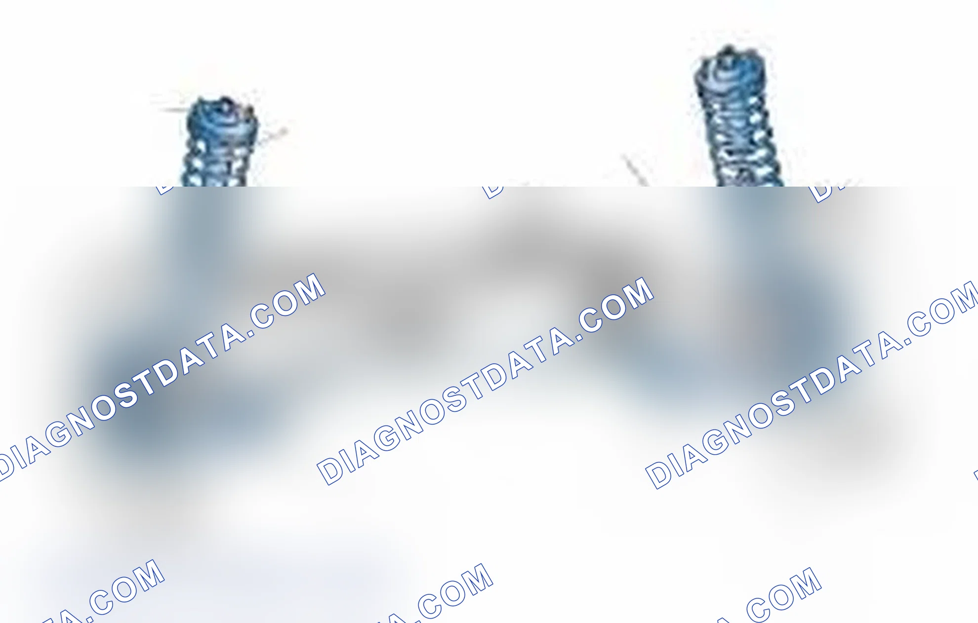 Scheme 25: Typical Front Suspension & Steering Components