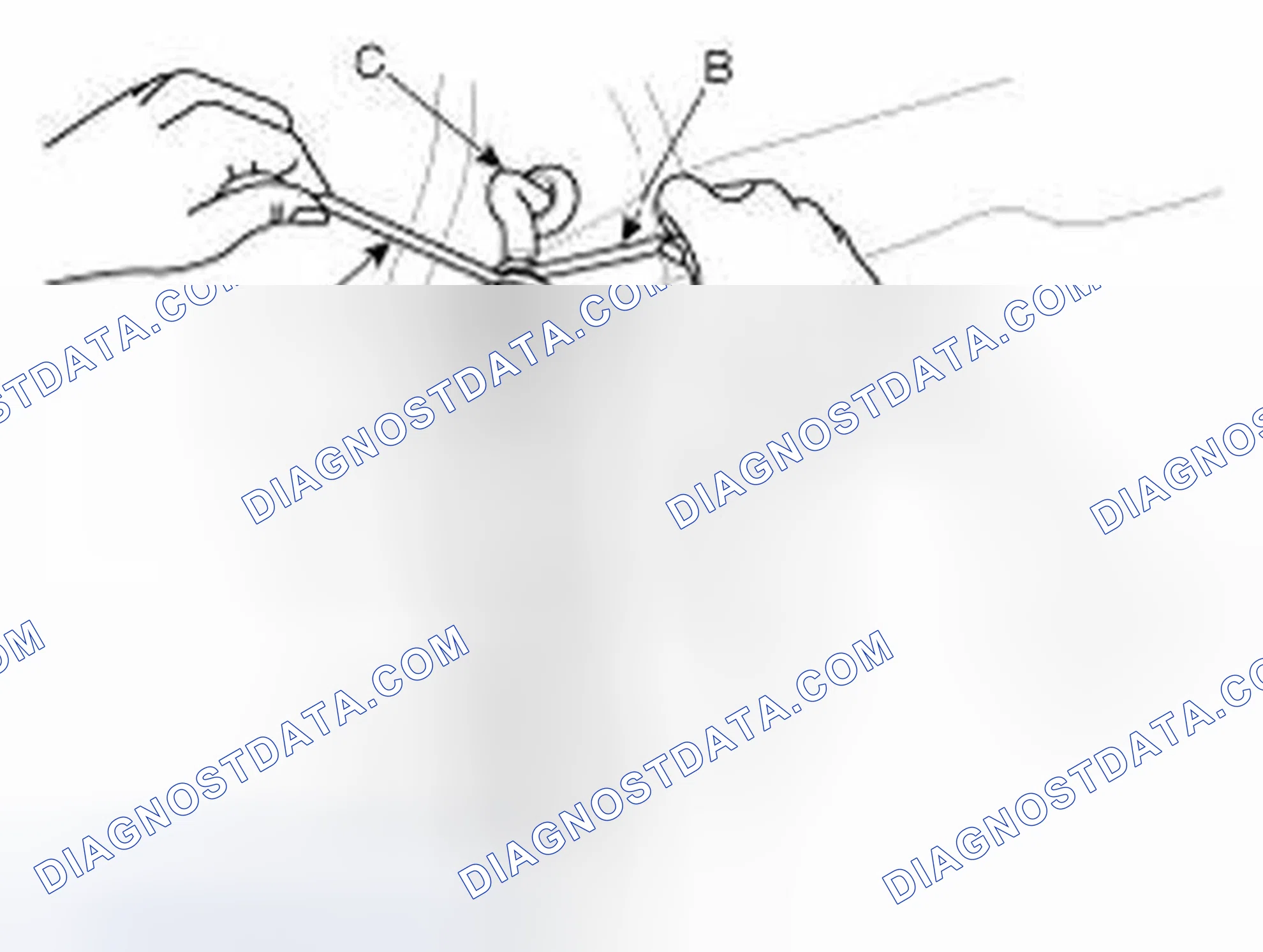 Scheme 5: REMOVAL