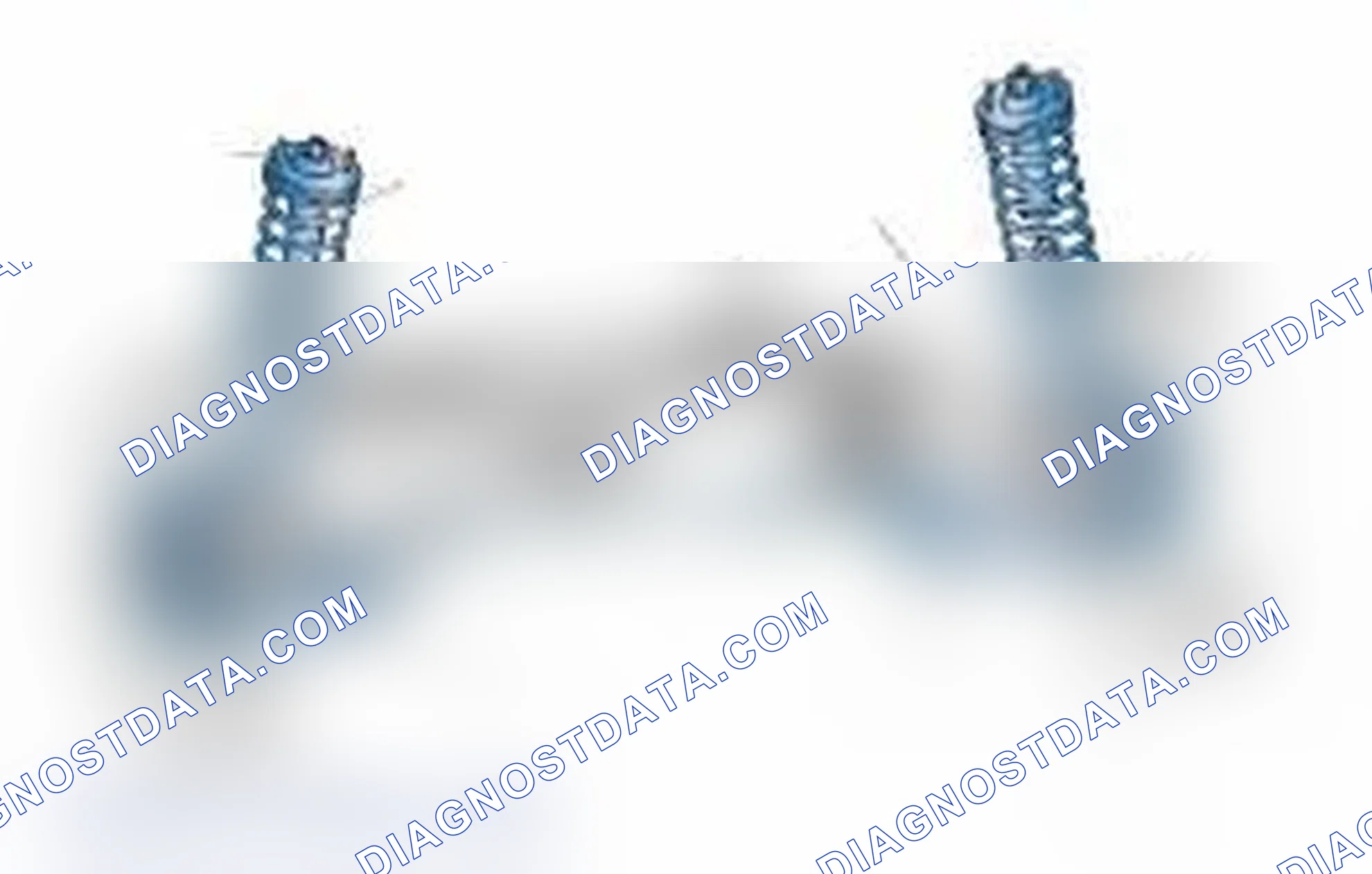 Scheme 25: Typical Front Suspension & Steering Components