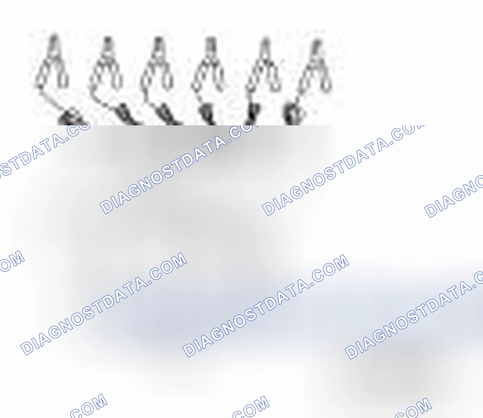 Scheme 13: Special Service Tools