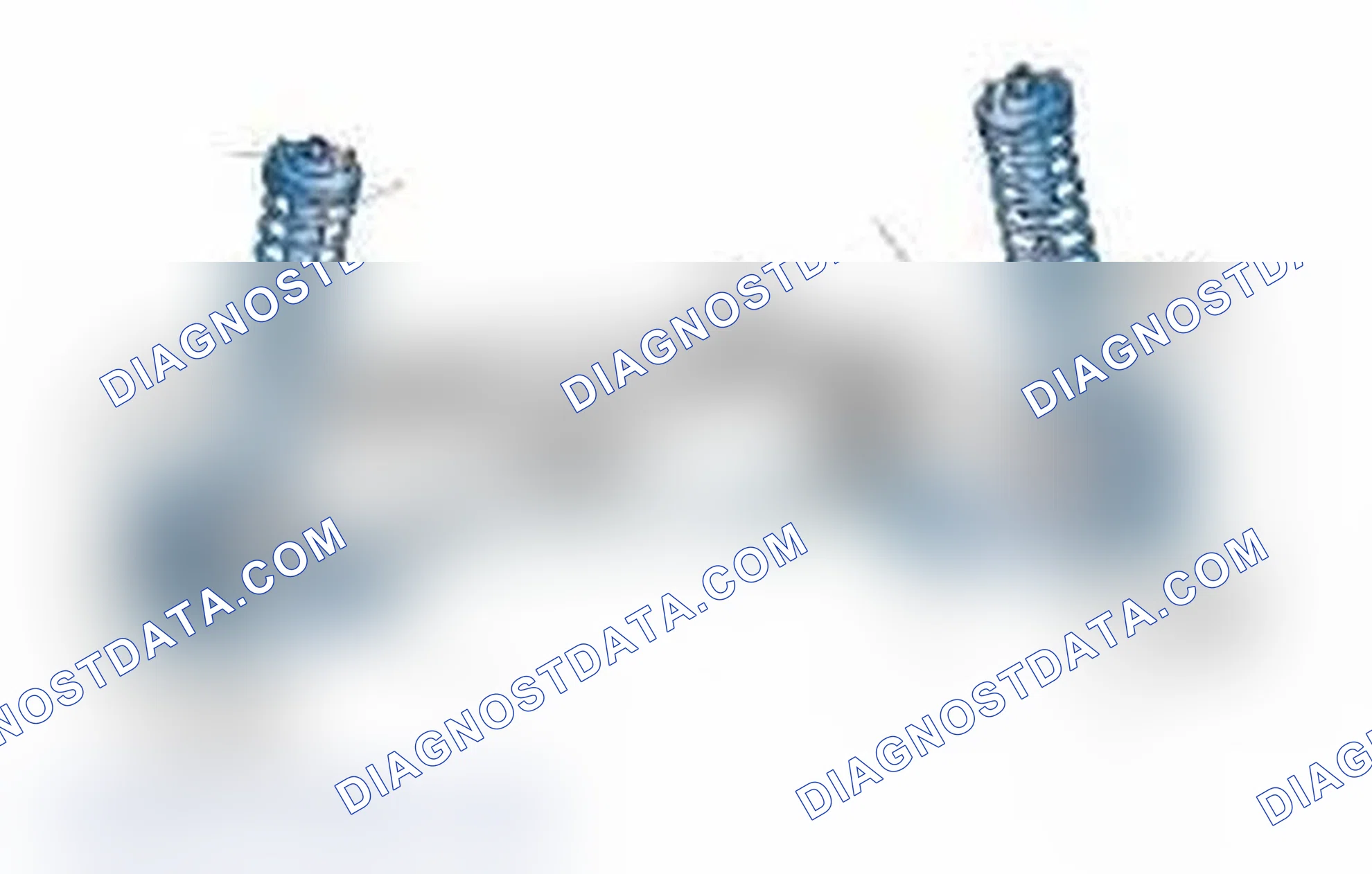 Scheme 25: Typical Front Suspension & Steering Components
