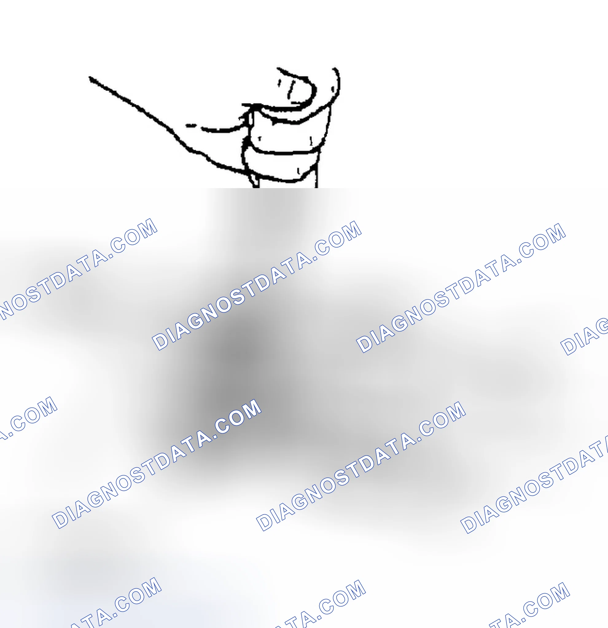 Scheme 10: STEERING LOCK MOUNTING BOLTS AND BRACKET REMOVAL NOTE