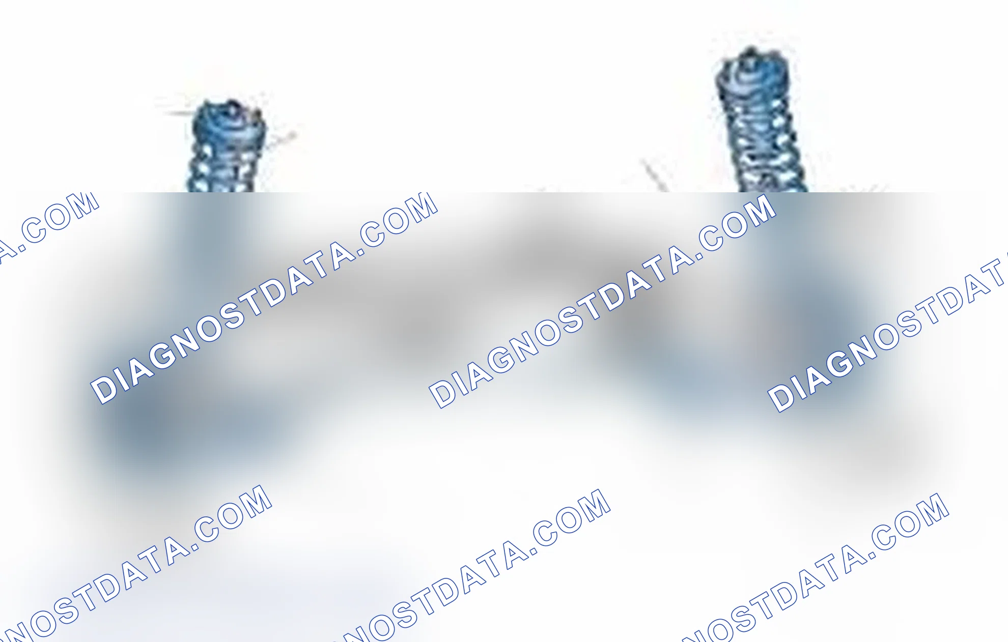 Scheme 25: Typical Front Suspension & Steering Components