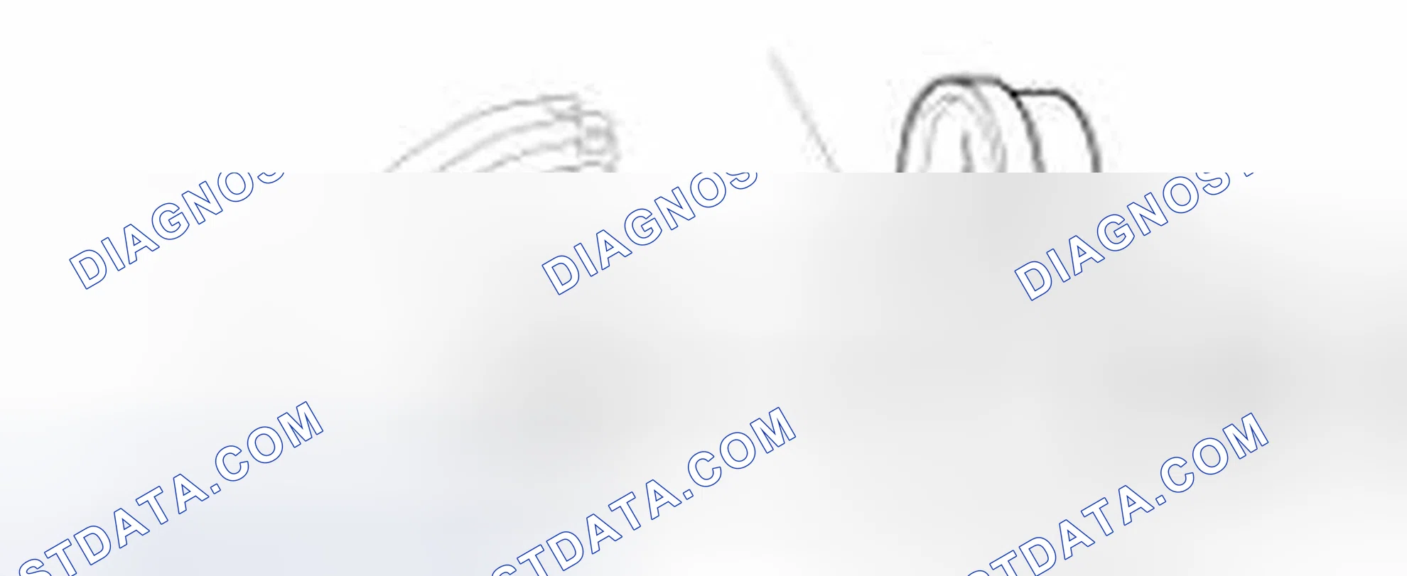 Scheme 13: Radiator Cap Testing