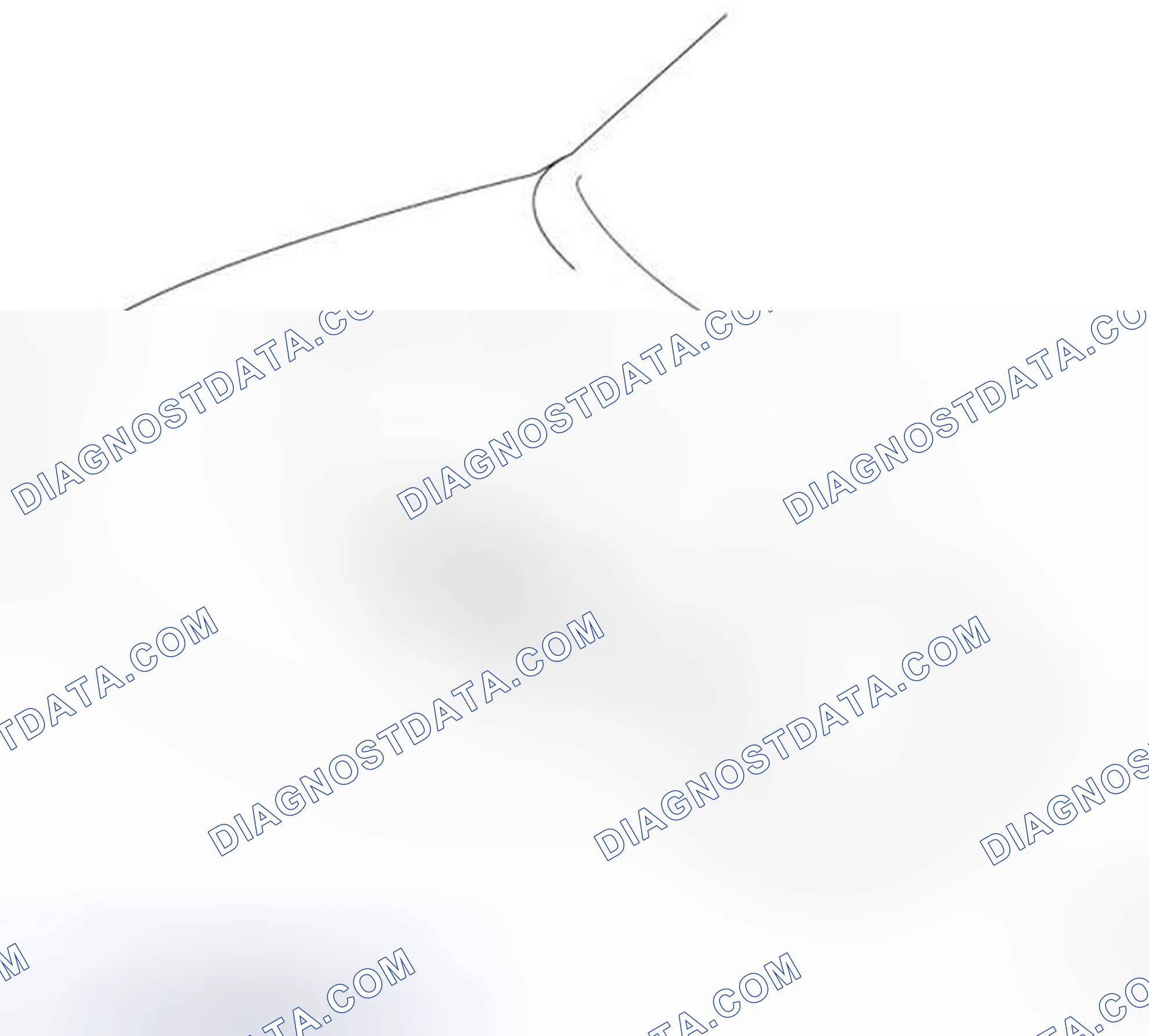 Scheme 30: Engine Mounting