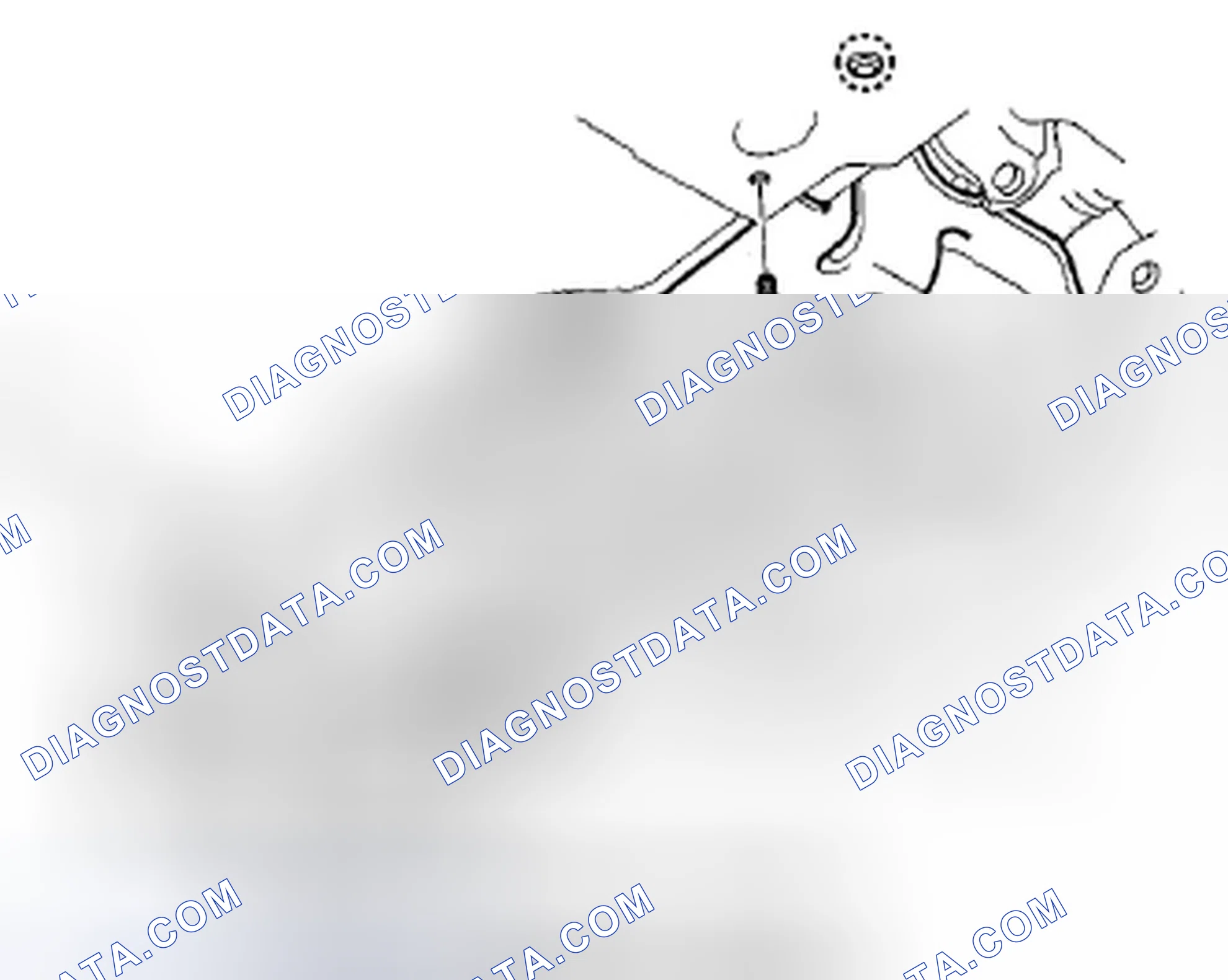 Scheme 38: Stabilizer Bar Replacement