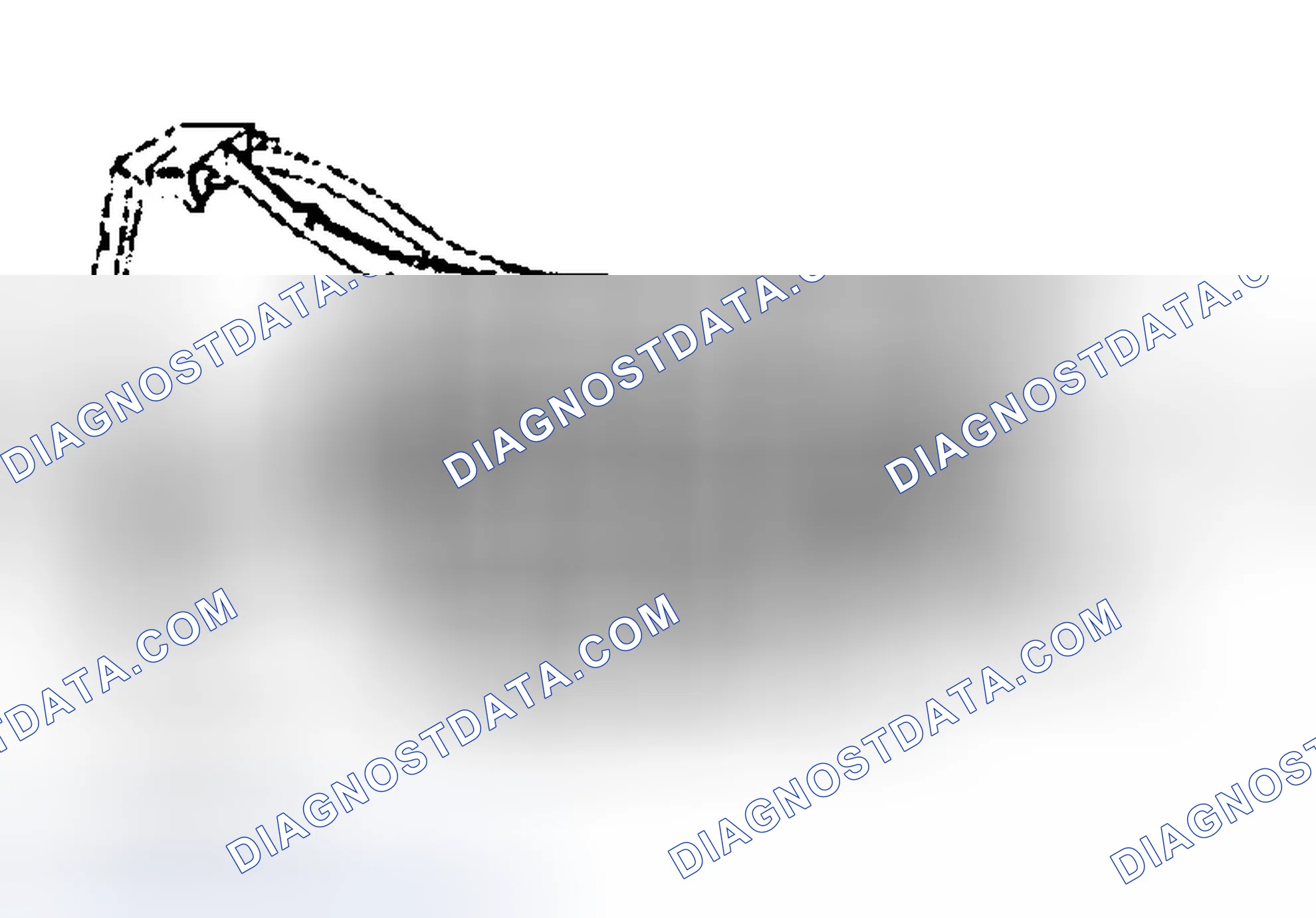 Scheme 23: TRANSMISSION