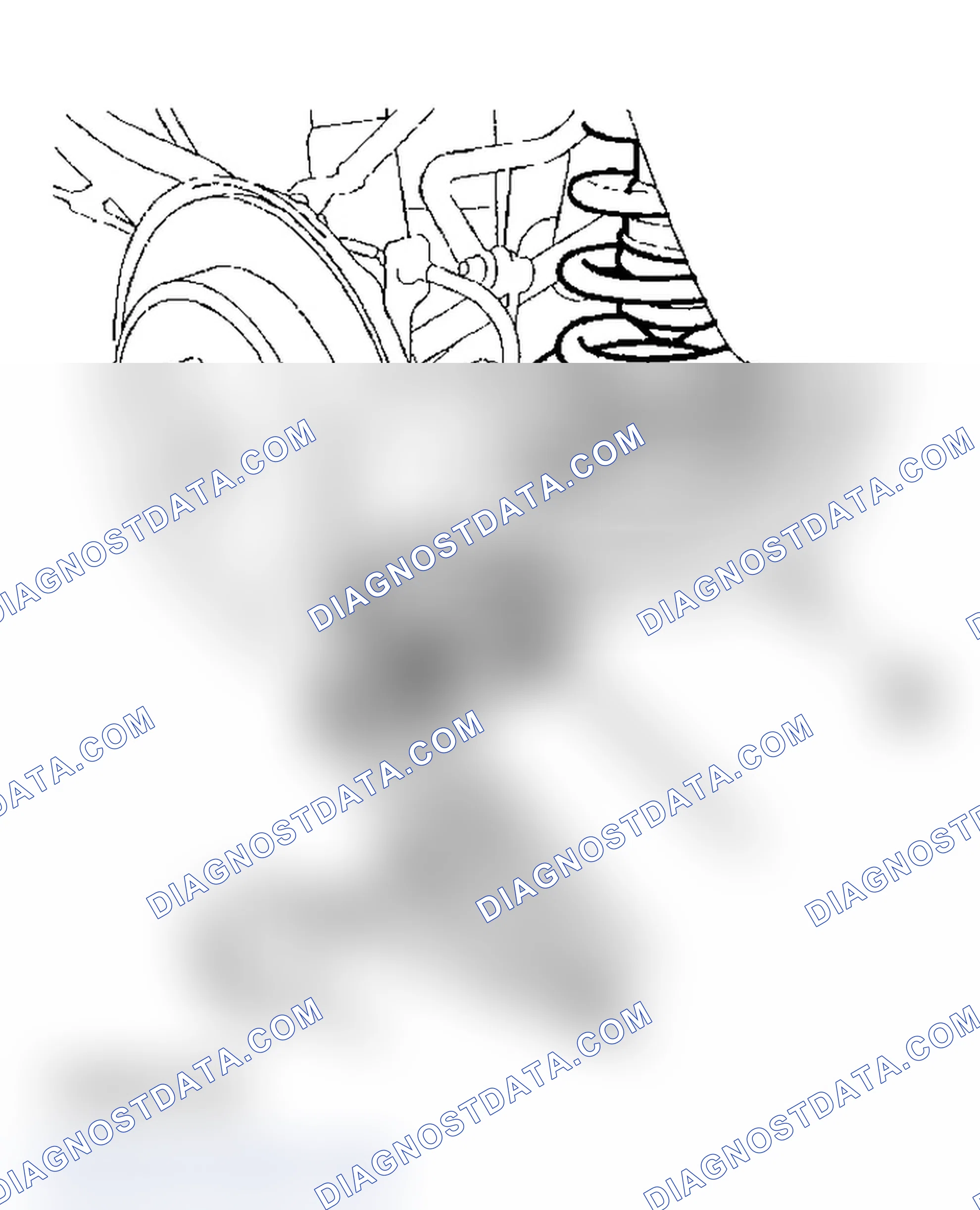 Scheme 24: Upper Arm Removal/Installation