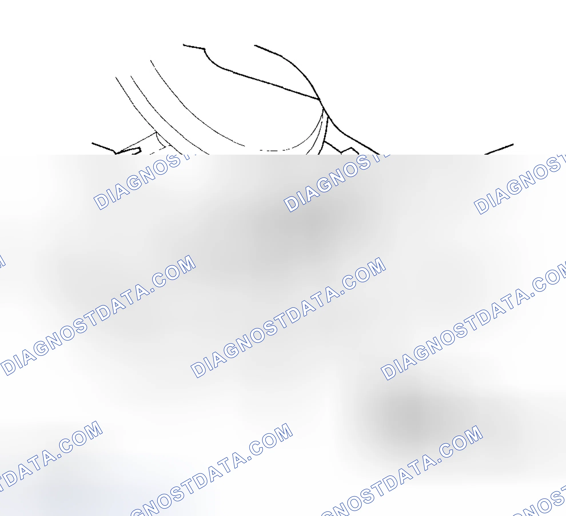 Scheme 148: Transfer Assembly Removal