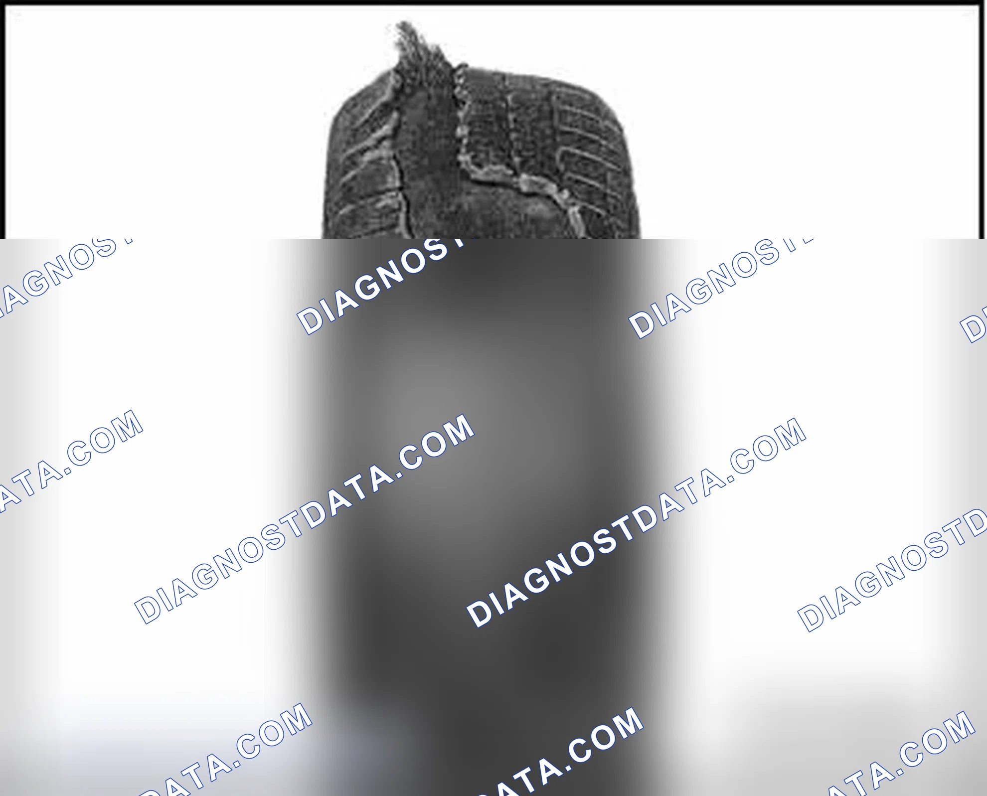 Scheme 125: DISINTEGRATED TREAD