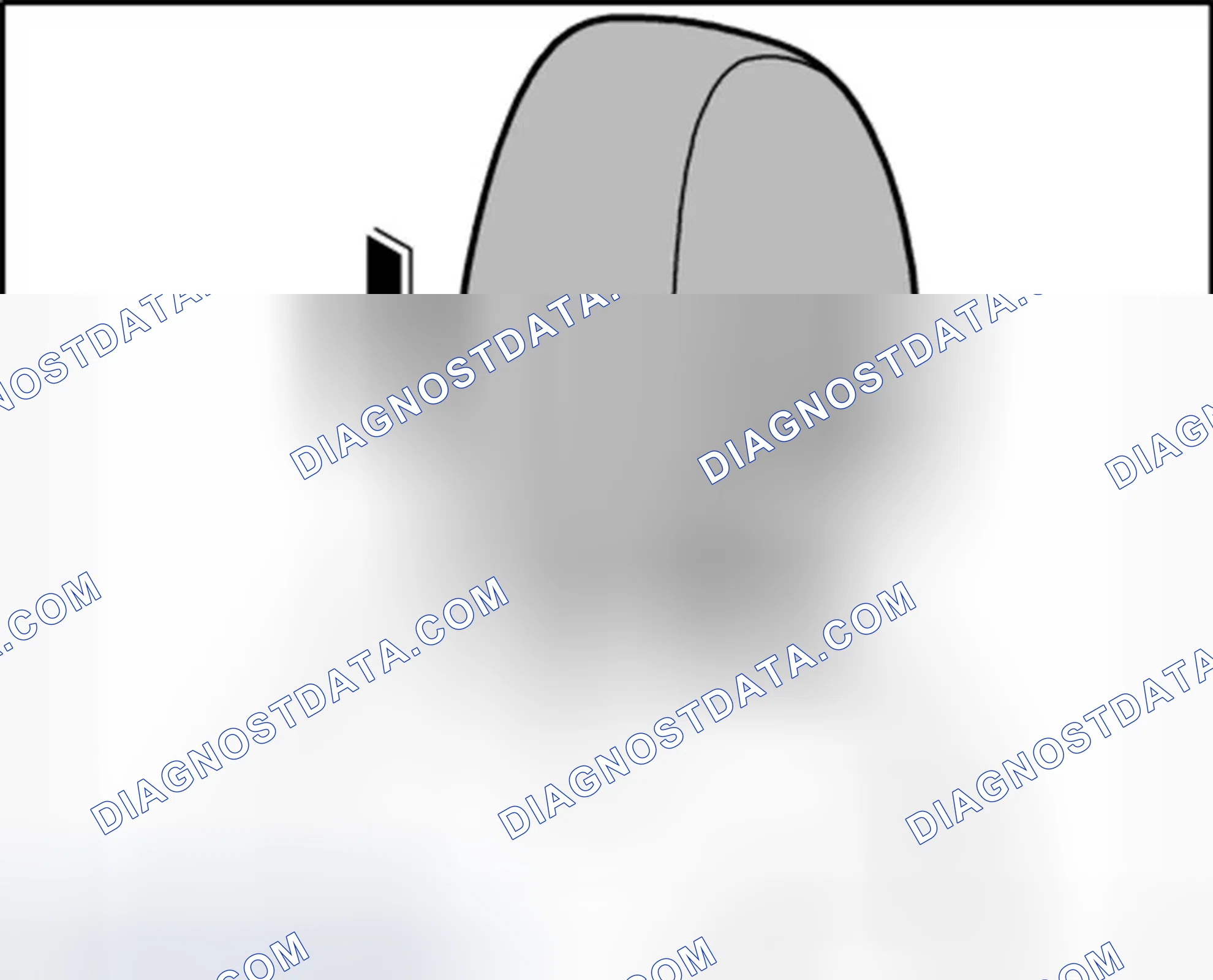 Scheme 179: Installing headrest