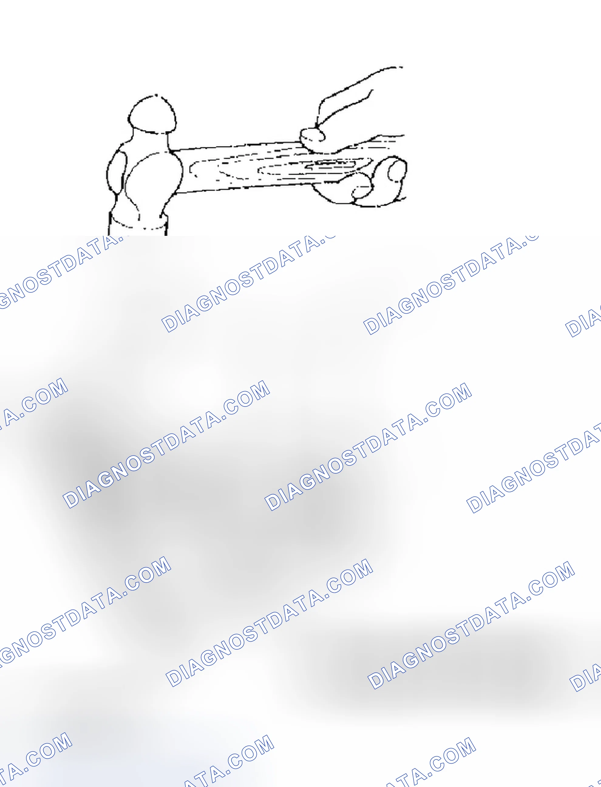 Scheme 17: Installation