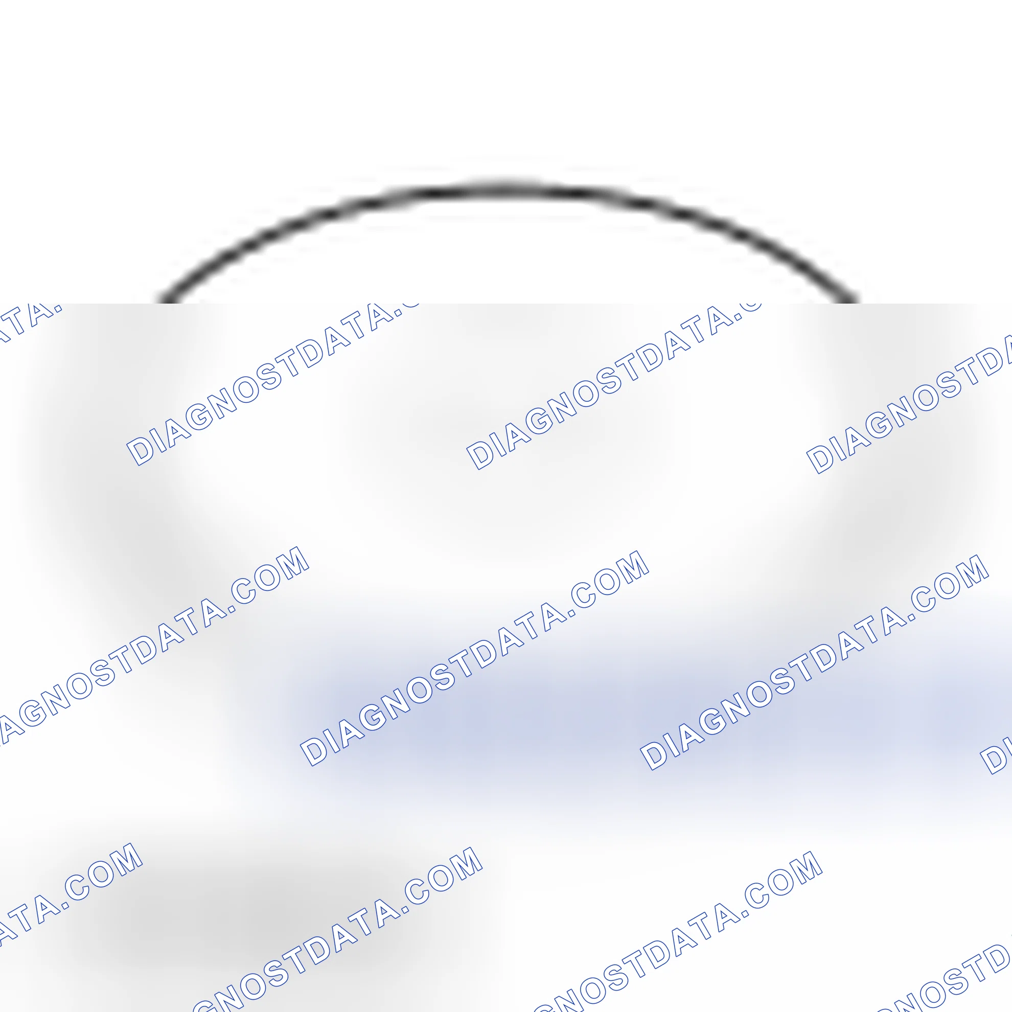 Scheme 74: Transaxle Case