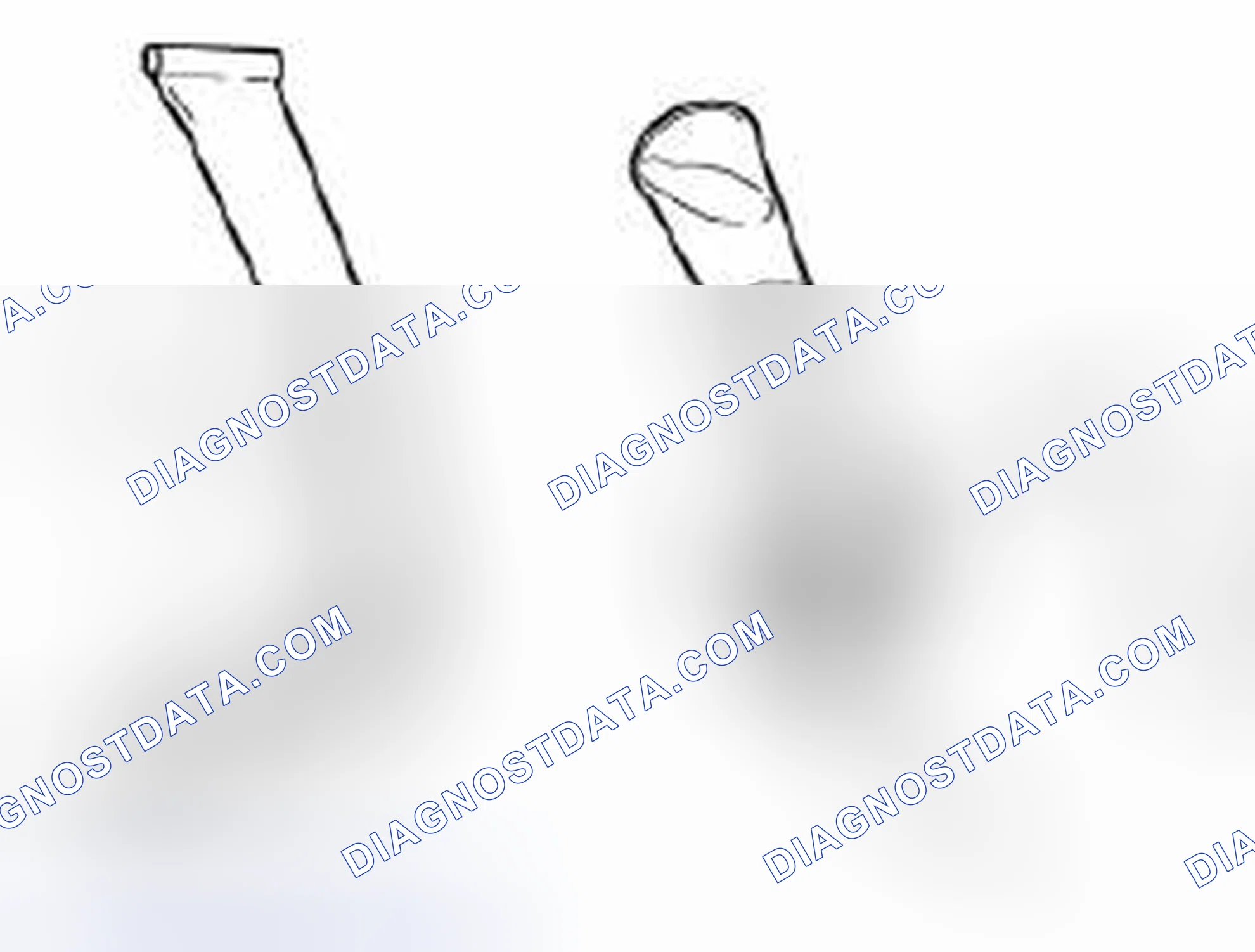 Scheme 9: Reassembly