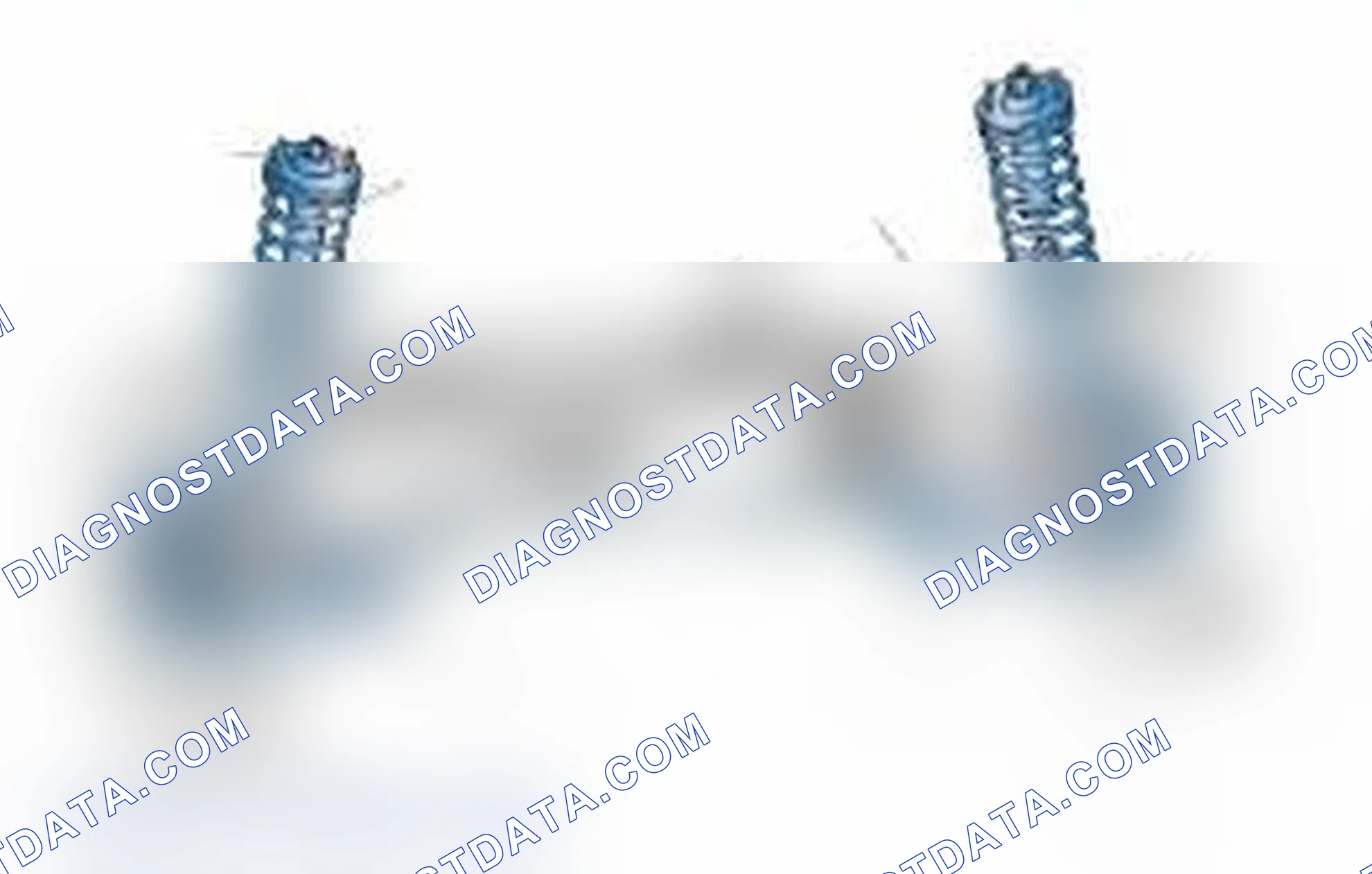 Scheme 25: Typical Front Suspension & Steering Components