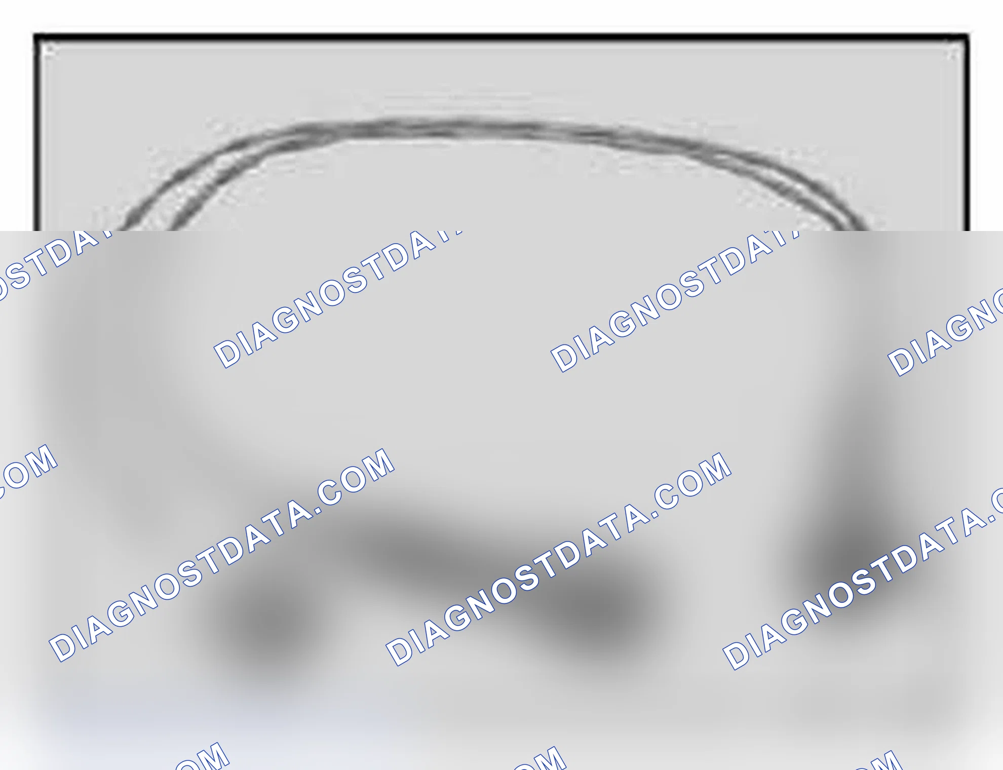 Scheme 306: 61 4 370 V-adapter lead (2-pin), zero-coded