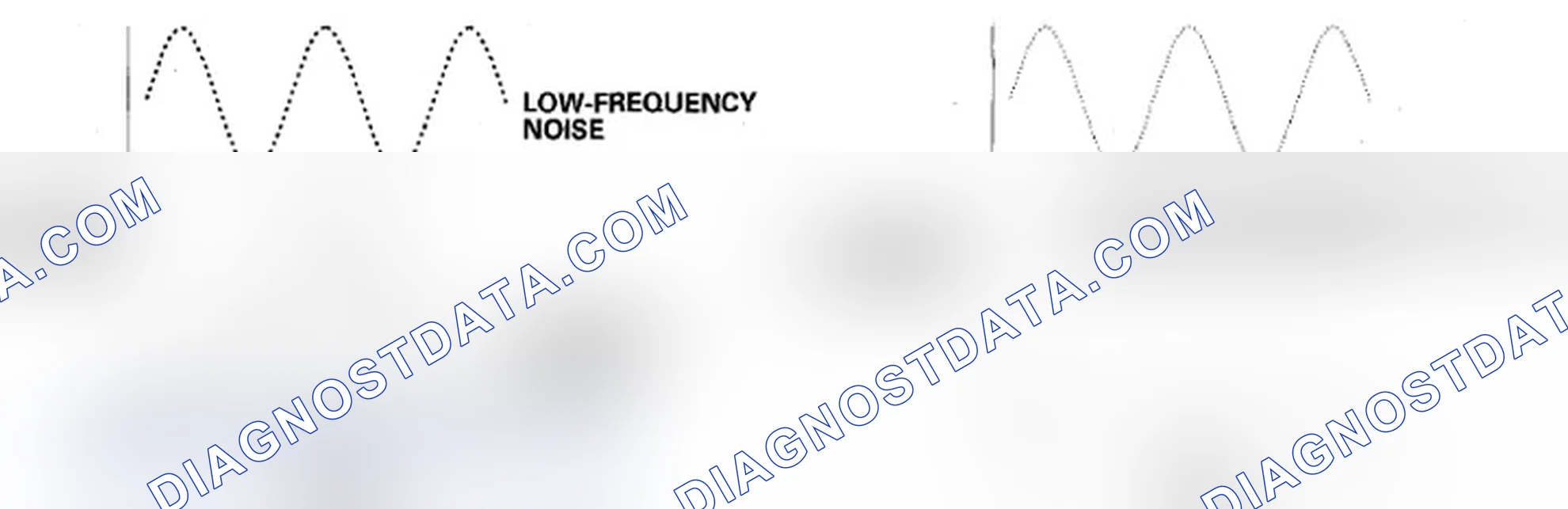 Scheme 5: Active Noise Cancellation (ANC) System