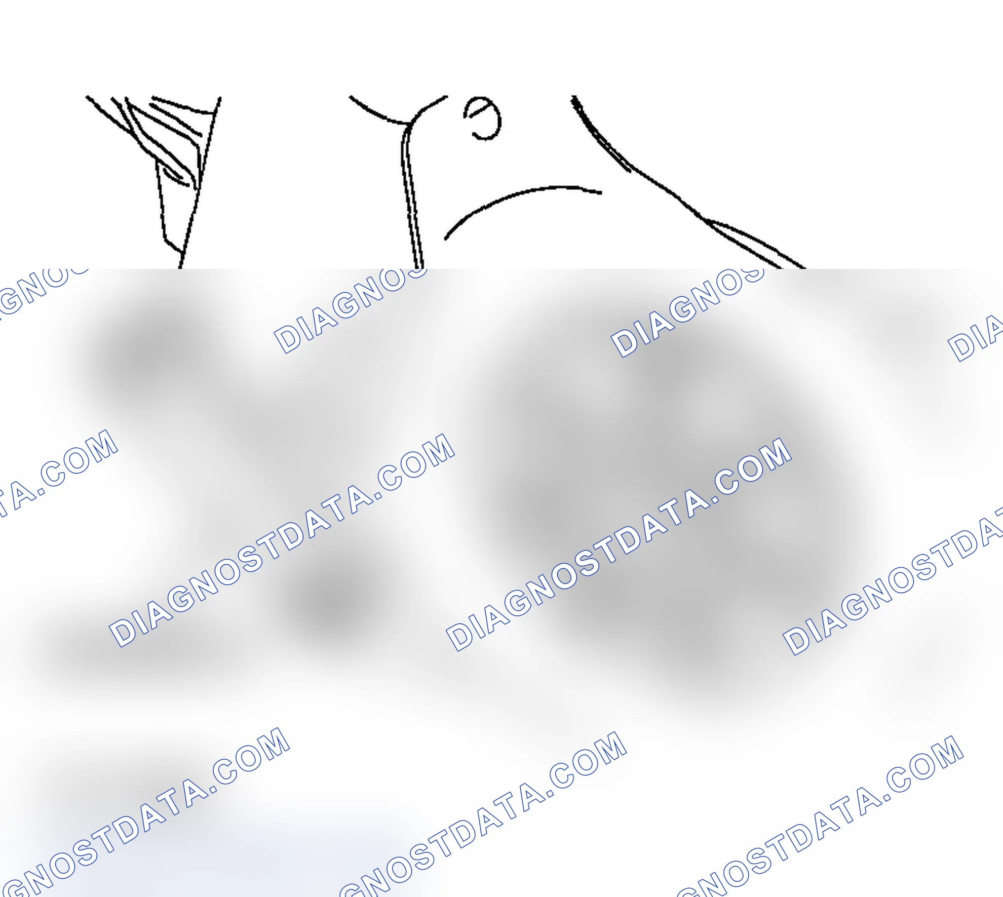 Scheme 593: << C>> CRANKSHAFT BOLT LOOSENING