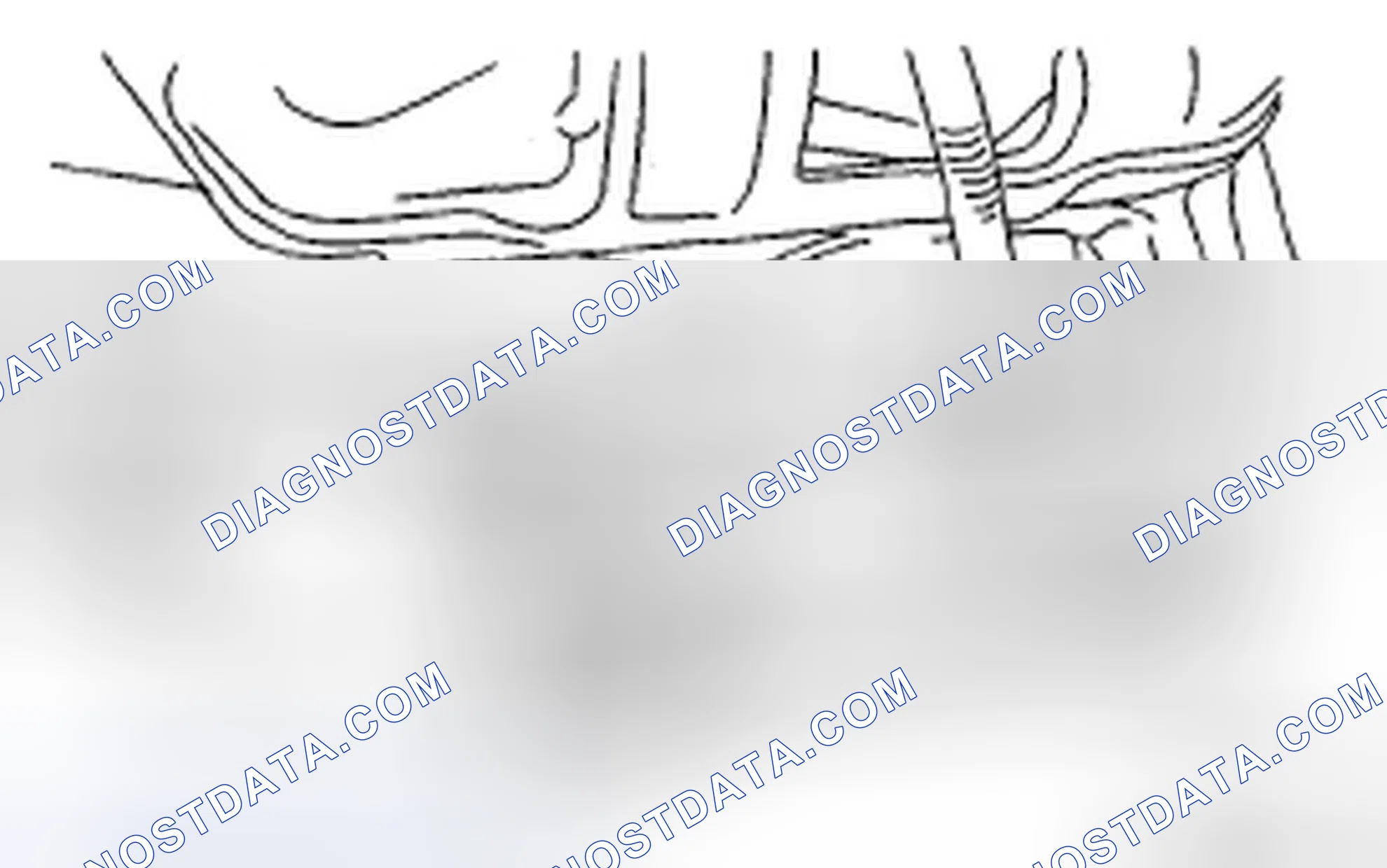 Scheme 19: Removing Spark Plug With Spark Plug Socket