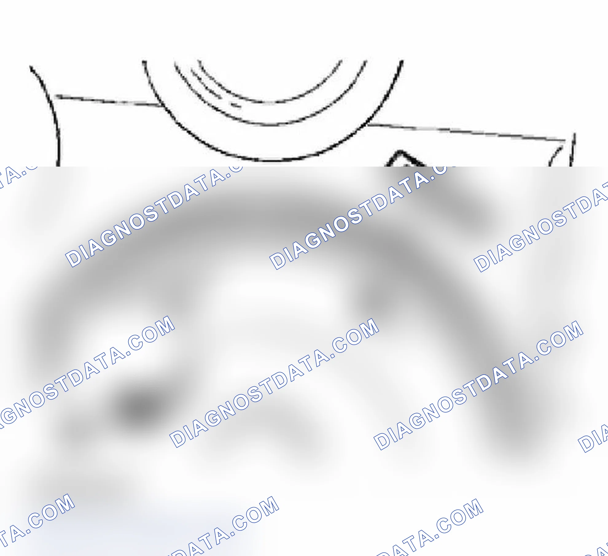 Scheme 635: REMOVING VALVE TAPPETS OF CYLINDER BANK 1 - 3