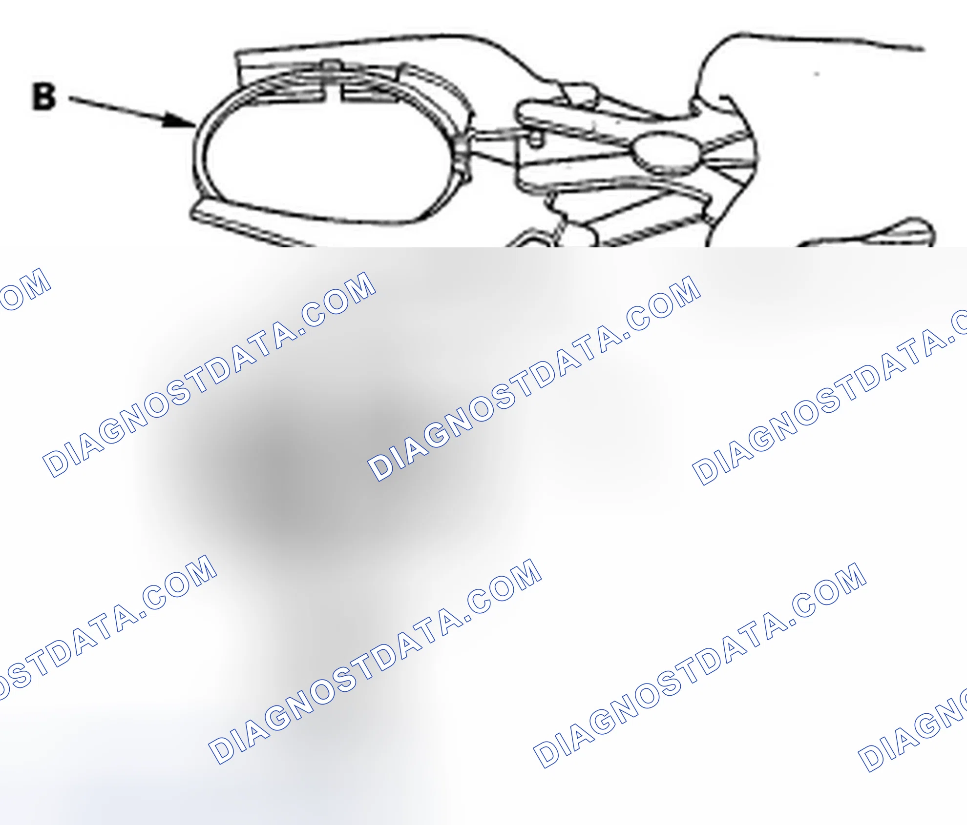 Scheme 260: Piston Ring Replacement