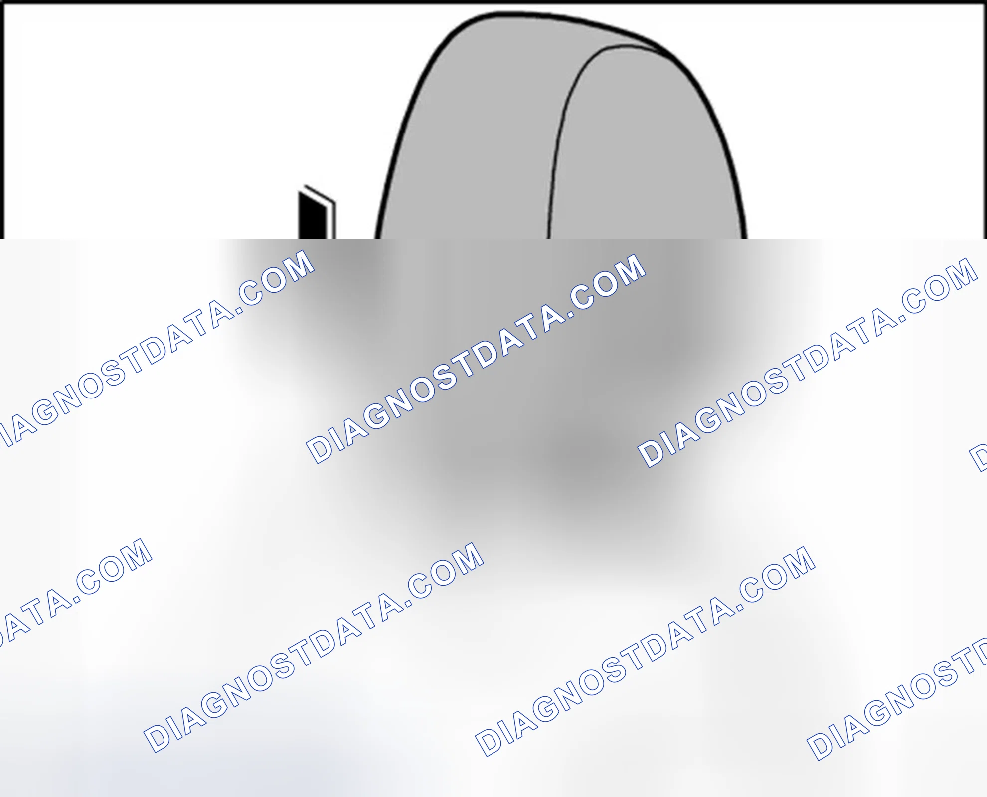 Scheme 179: Installing headrest