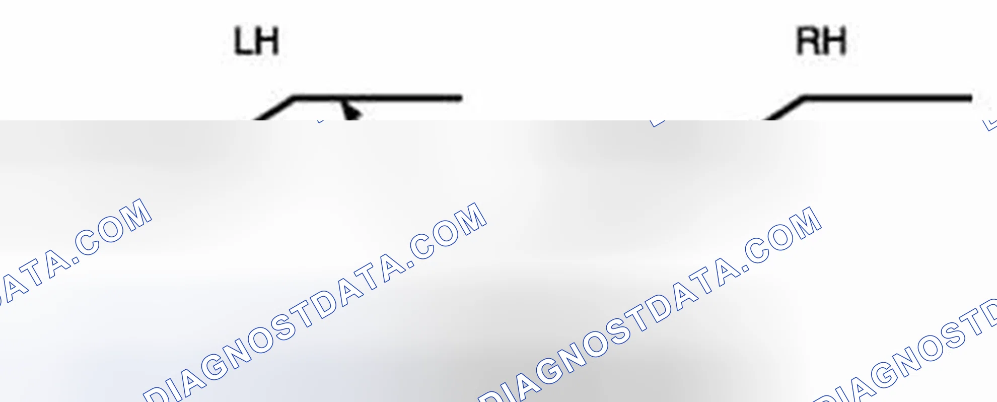 Scheme 2: Low-beam Adjustment