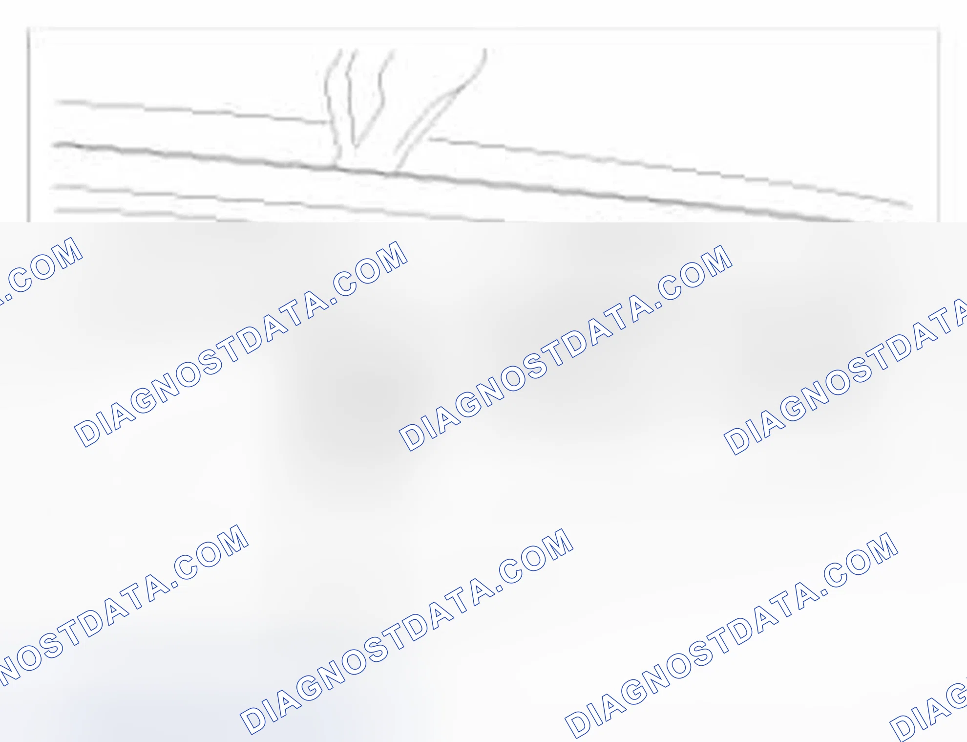 Scheme 10: Removal
