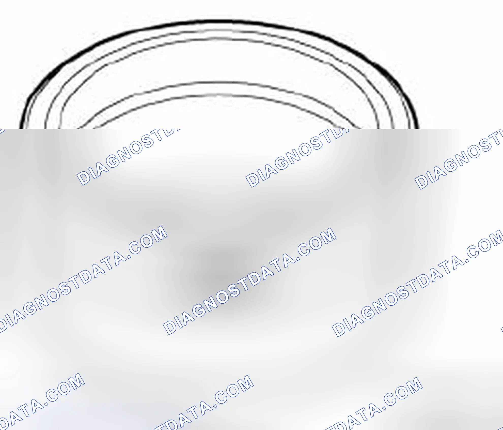 Scheme 30: 11 6 260 Mounting Sleeves With Case