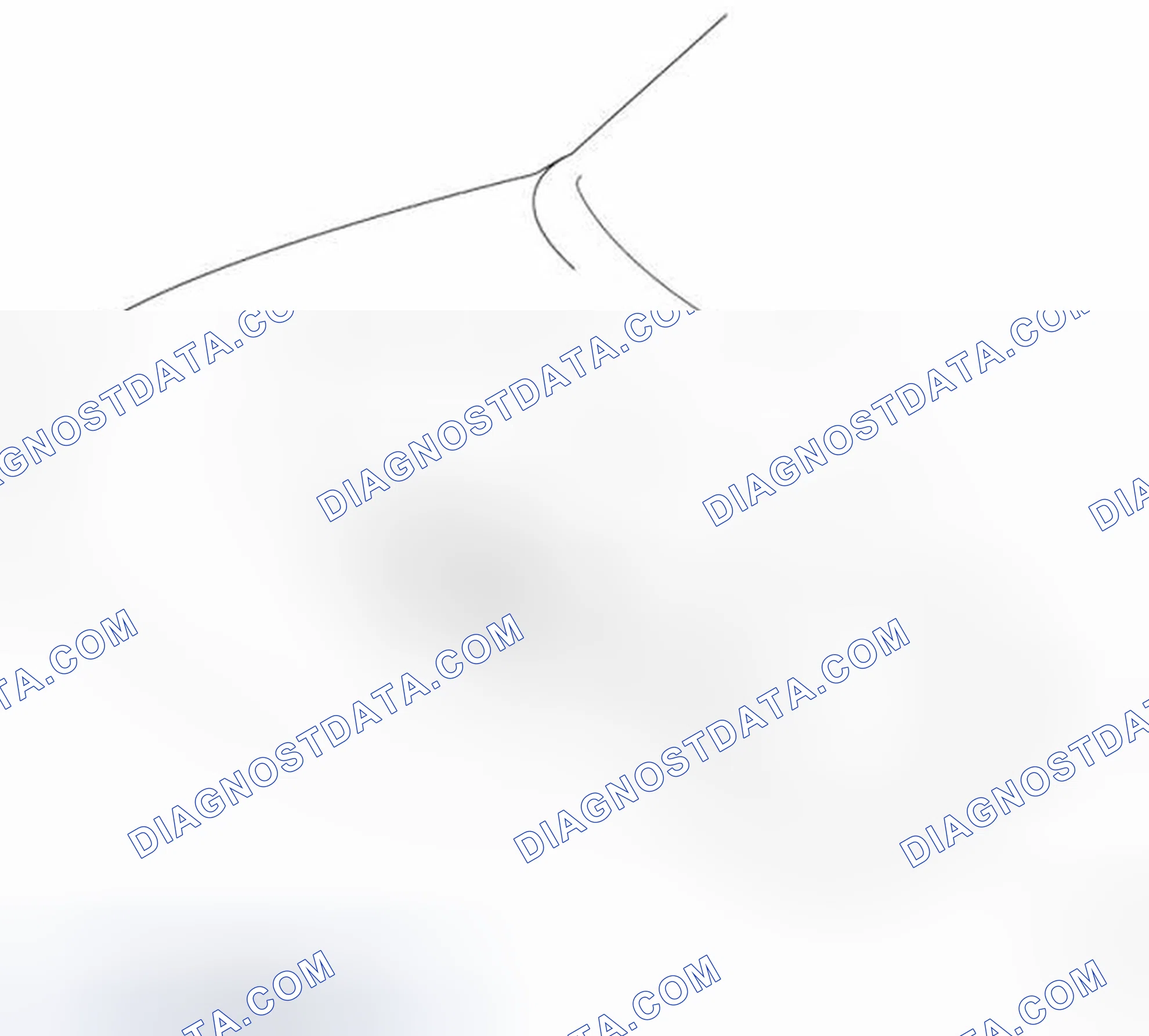 Scheme 30: Engine Mounting