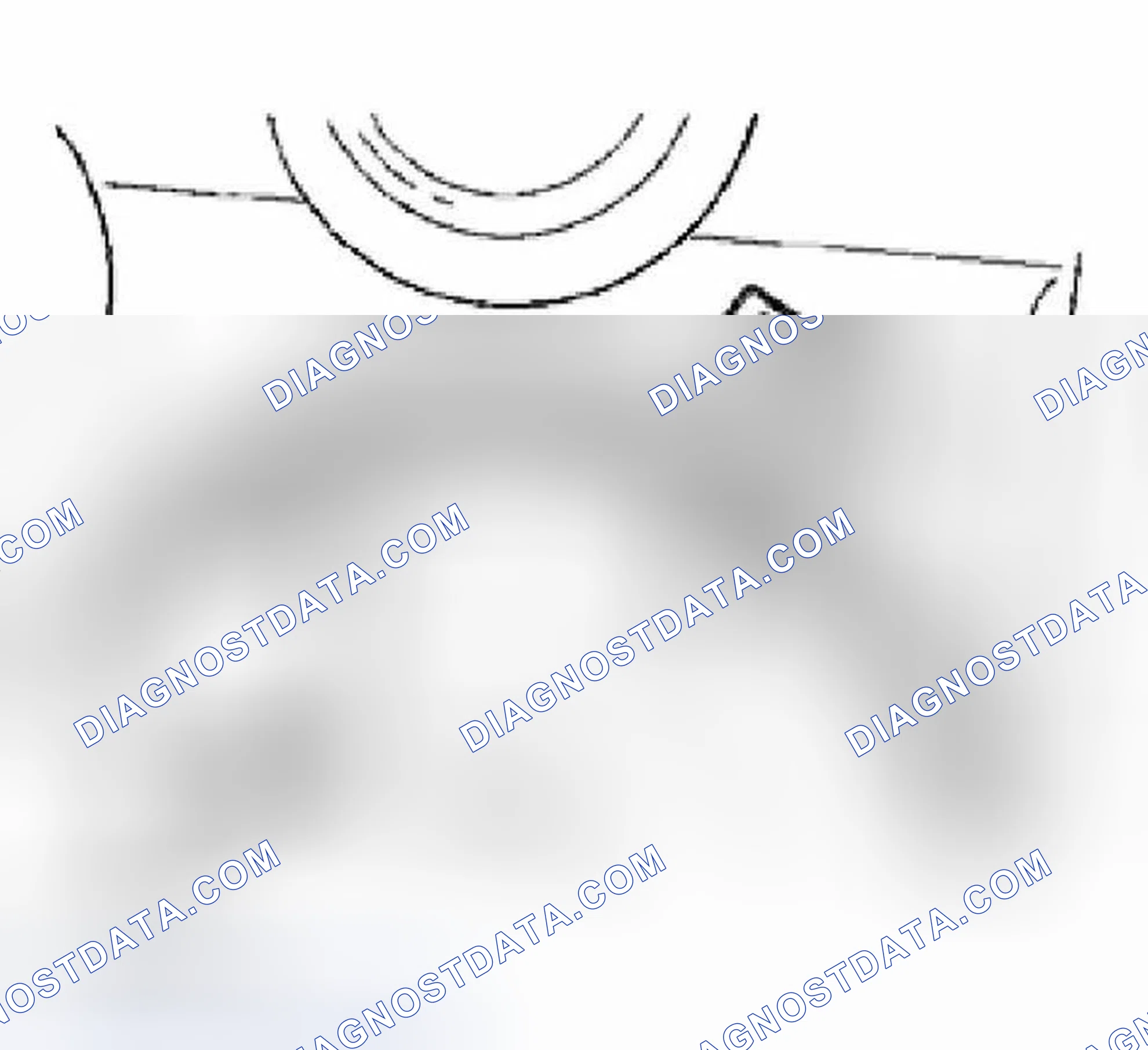 Scheme 71: REMOVING VALVE TAPPETS OF CYLINDER BANK 4 - 6