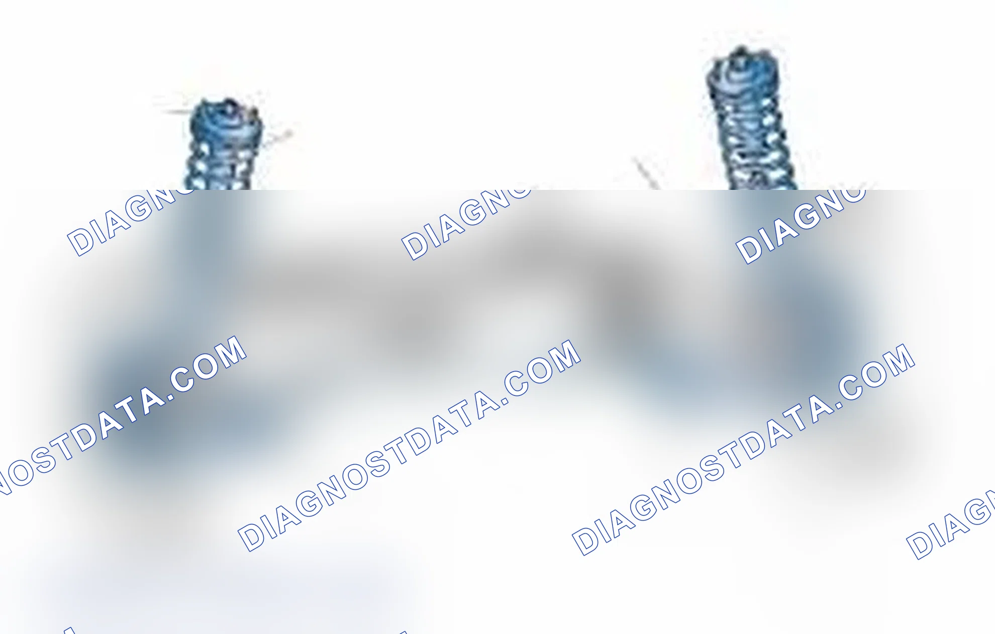 Scheme 25: Typical Front Suspension & Steering Components