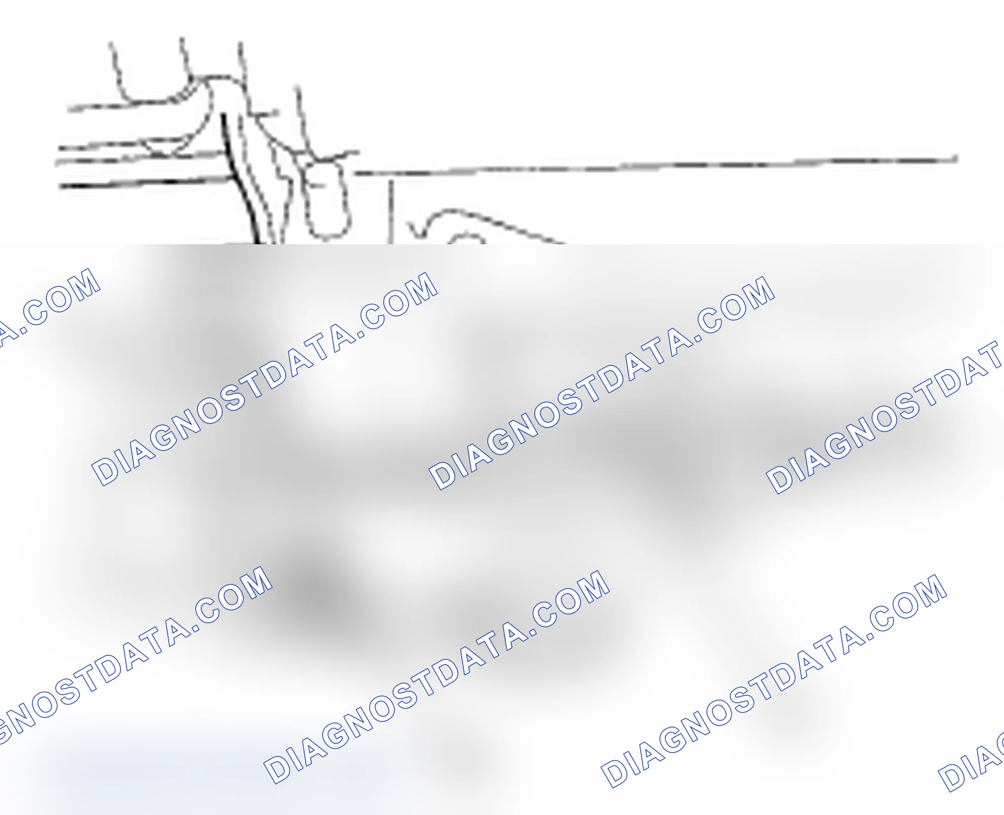 Scheme 7: Seat Belt Buckle