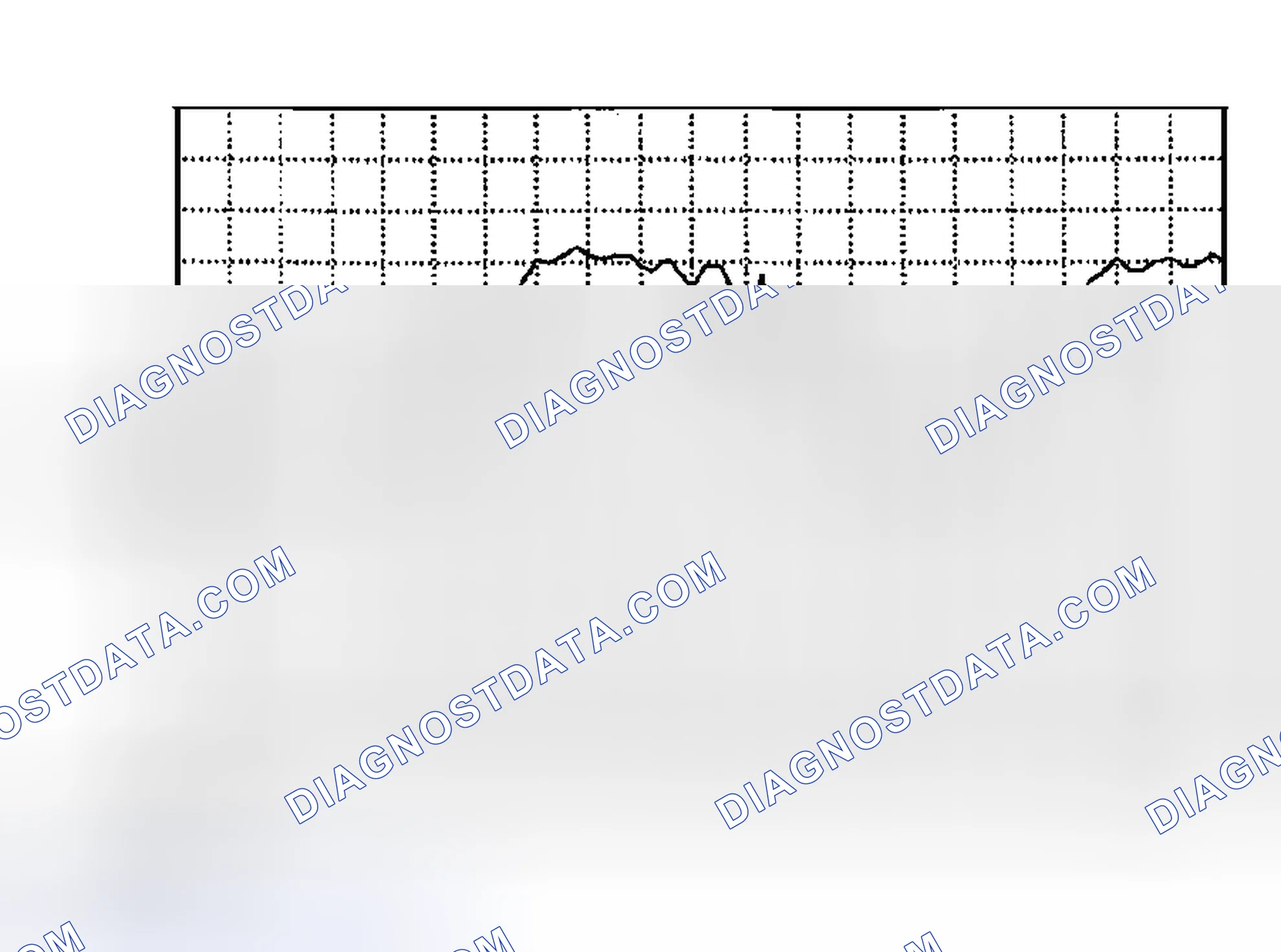 Scheme 353: HO2S signal (front, RH/LH)