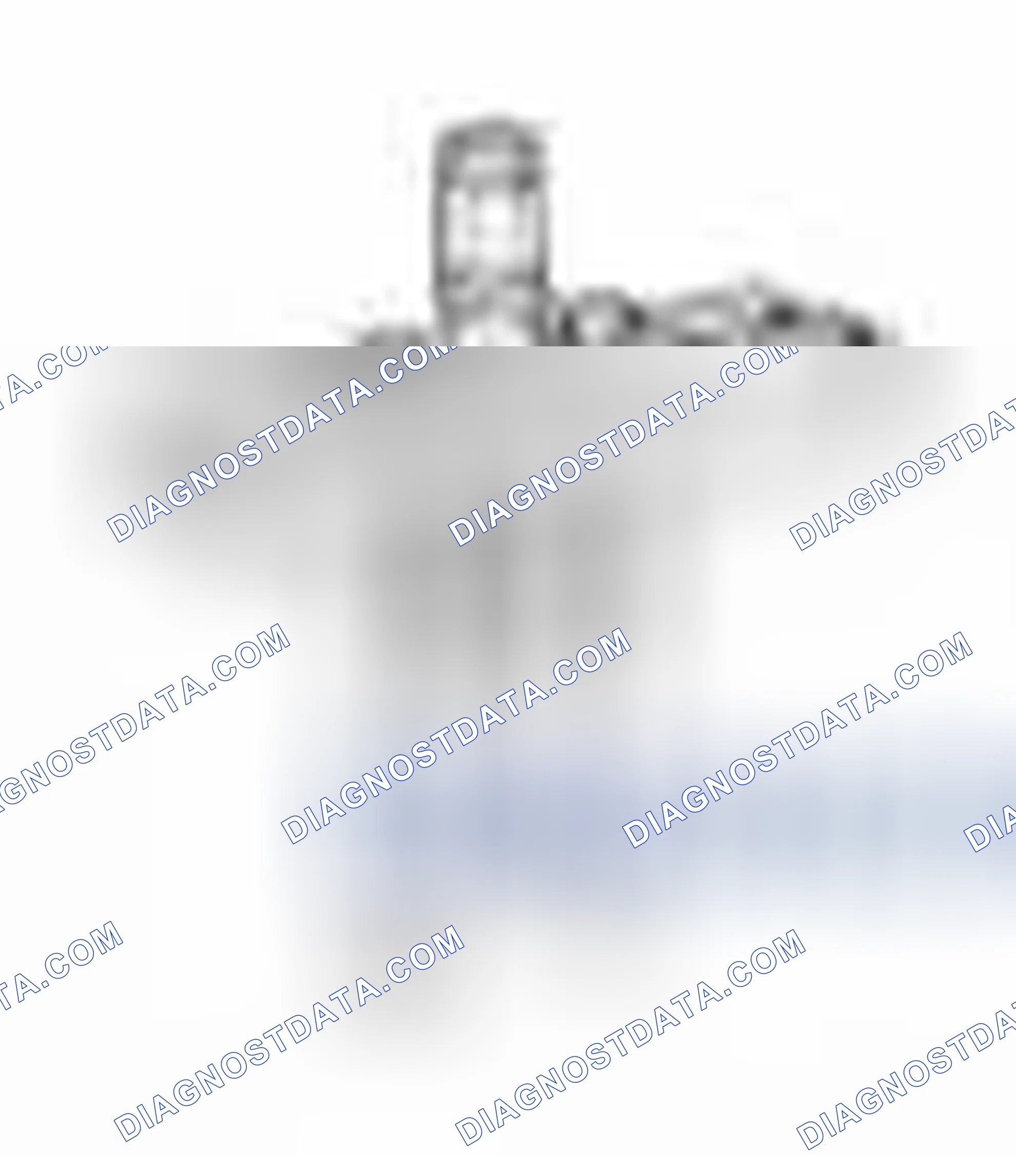Scheme 1: Special Service Tools