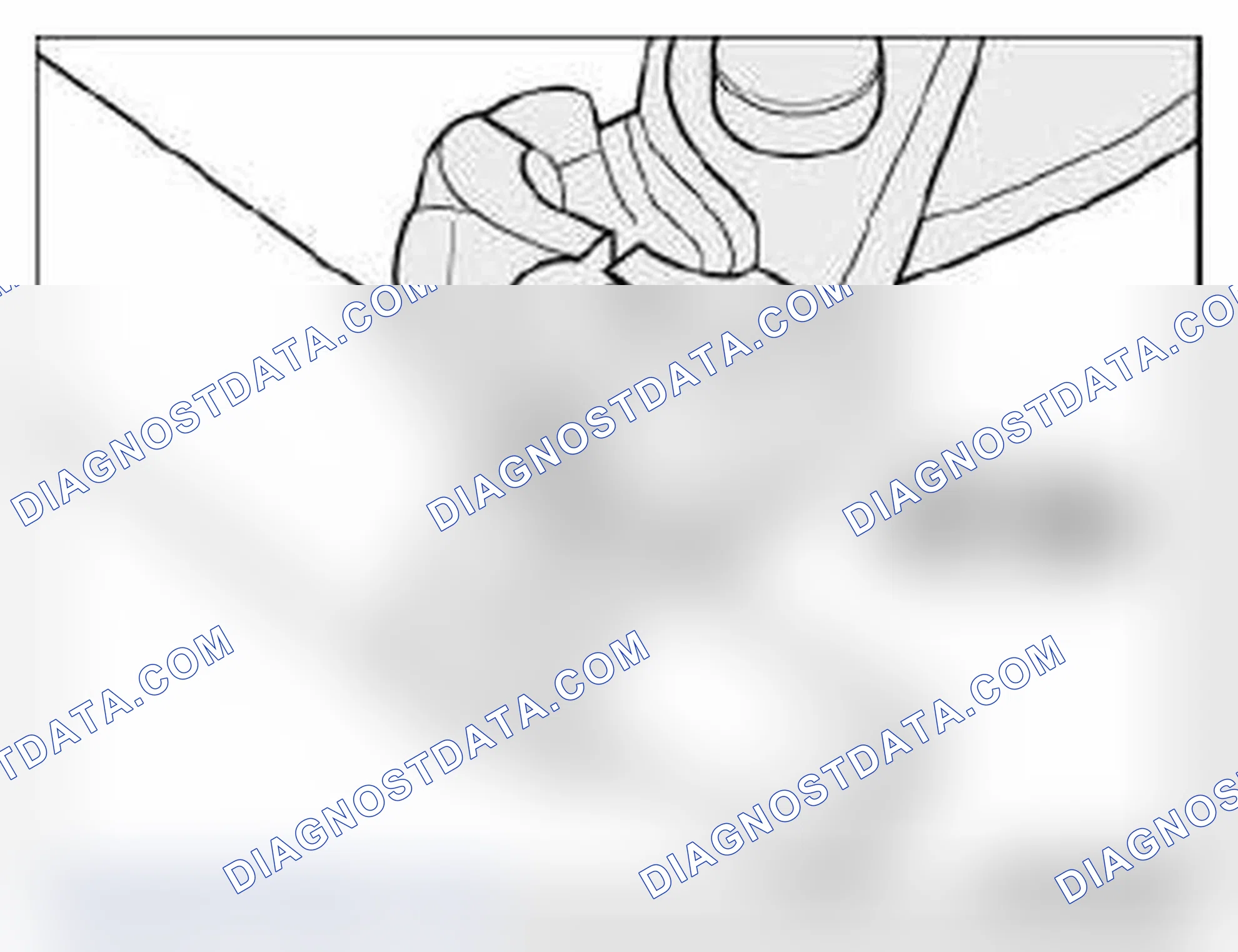 Scheme 74: 32 41... Instructions for removing and installing ear clips