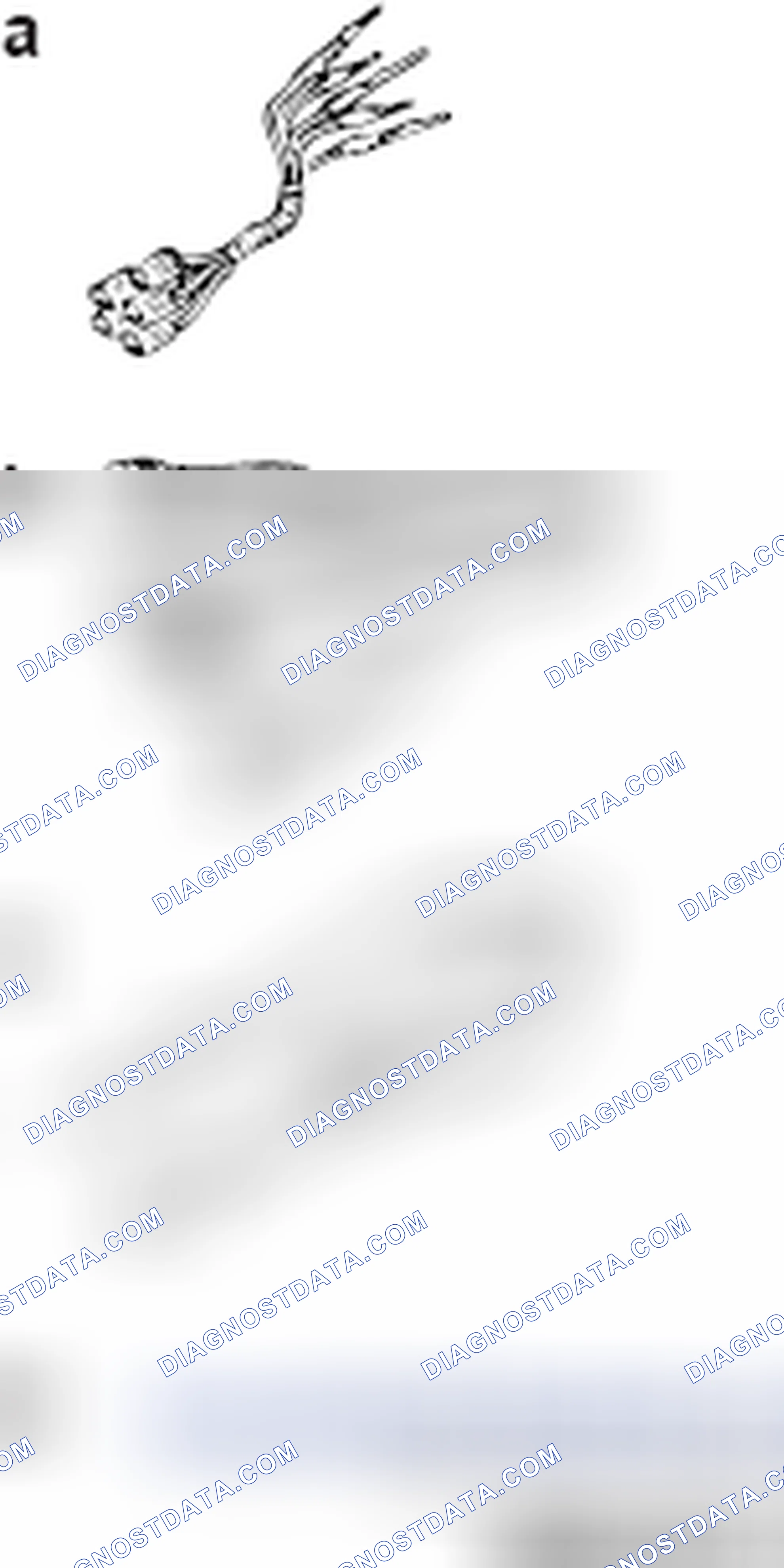 Scheme 8: SPECIAL TOOLS