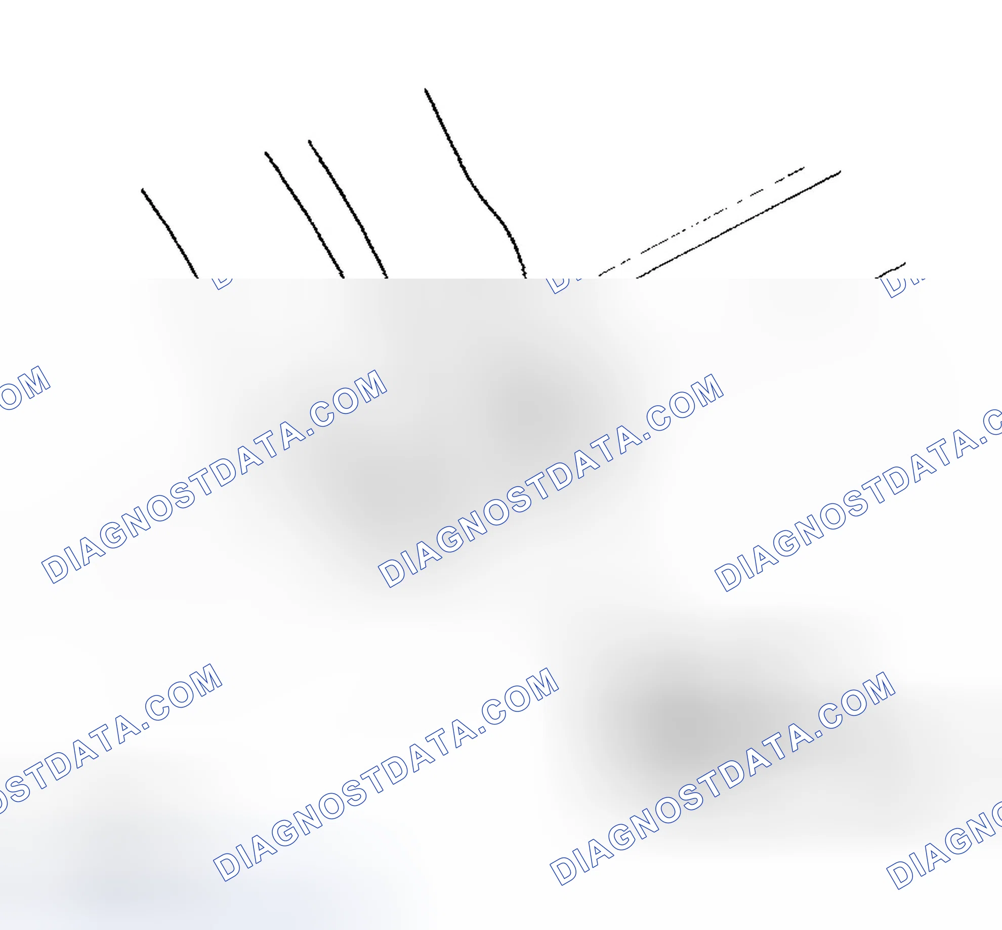 Scheme 33: Seat Belt Buckle/Center Seat Belt Detachable Anchor