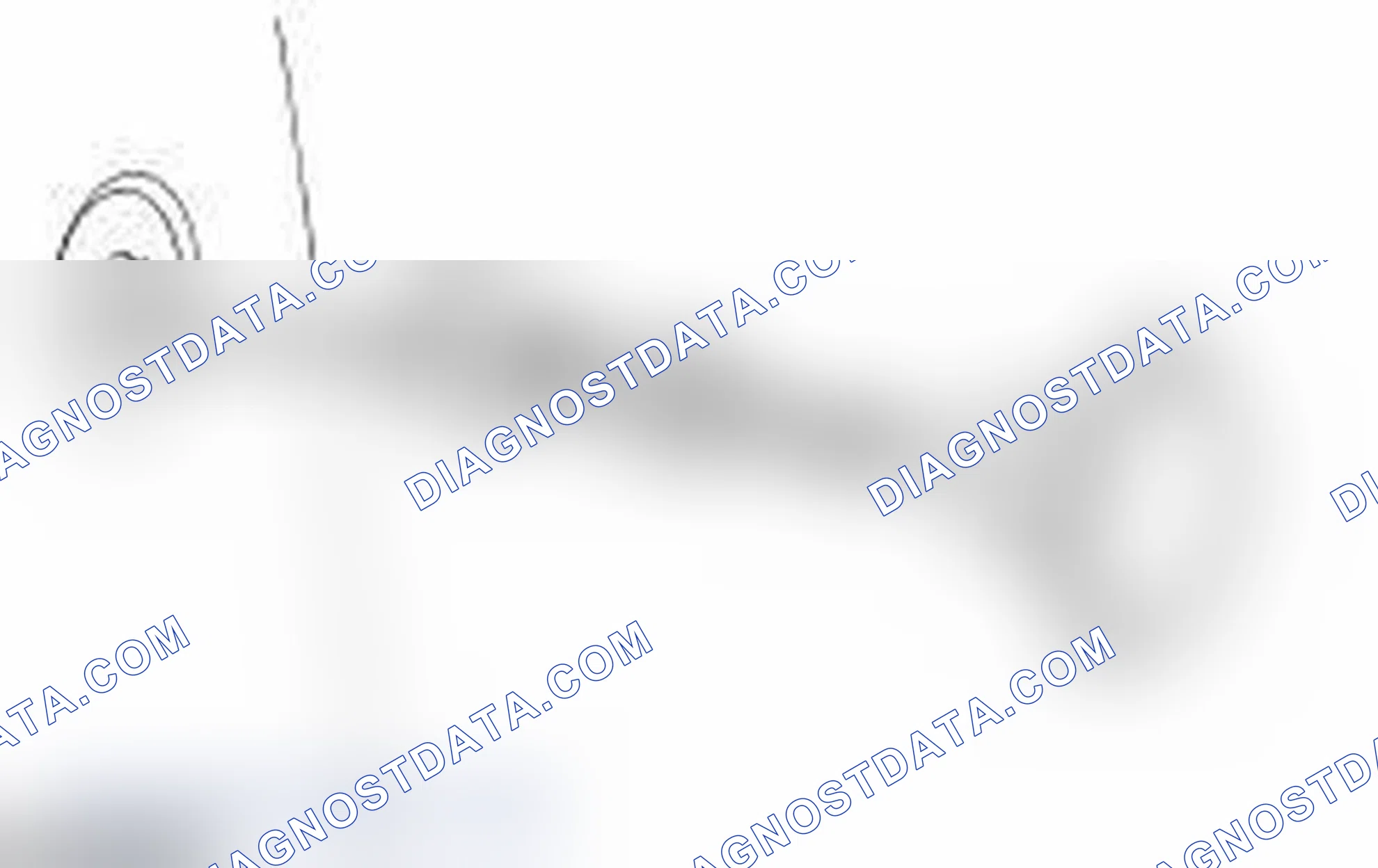 Scheme 23: REMOVAL