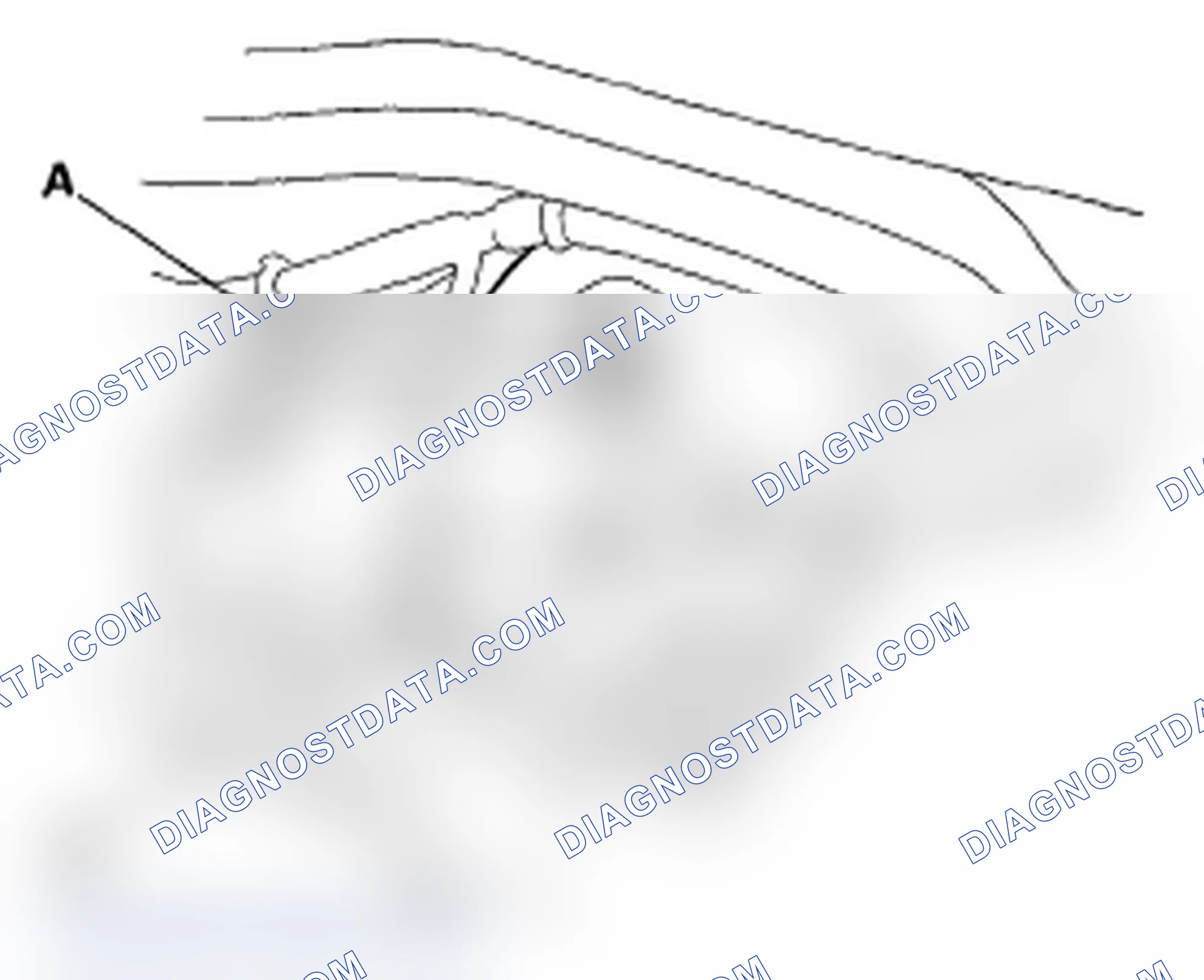 Scheme 35: Brake Booster Replacement