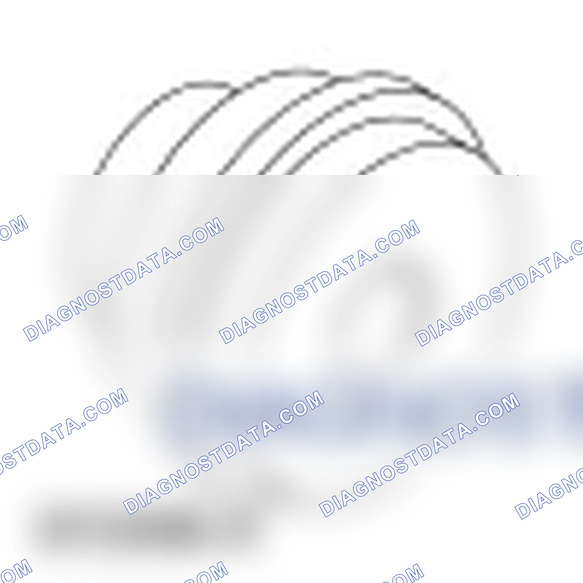 Scheme 158: Transaxle