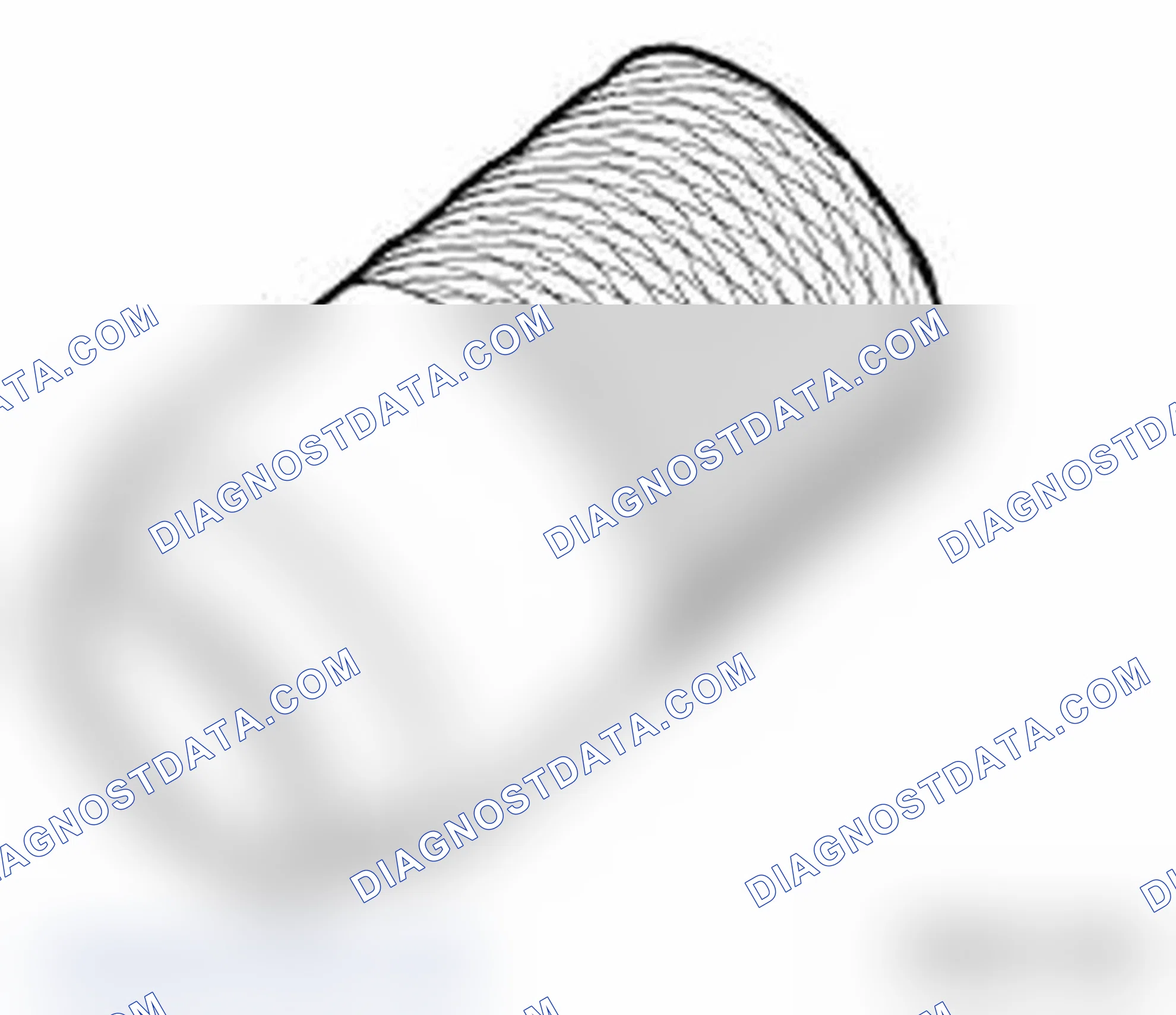 Scheme 63: Special Tool (23 0 190)