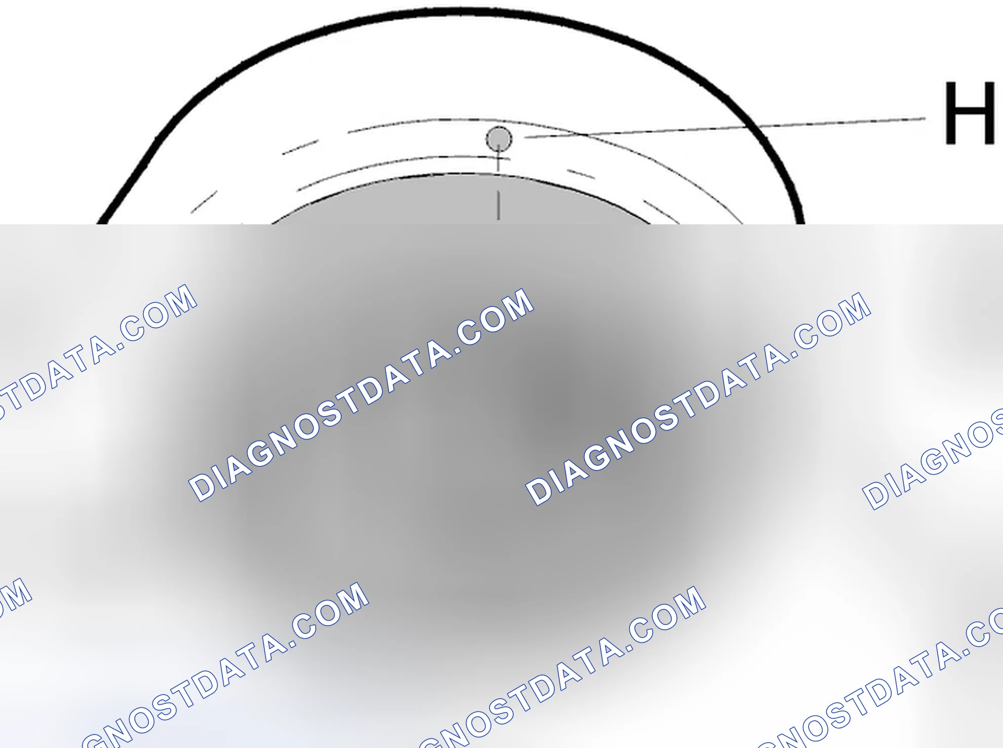 Scheme 30: Positioning the bushing