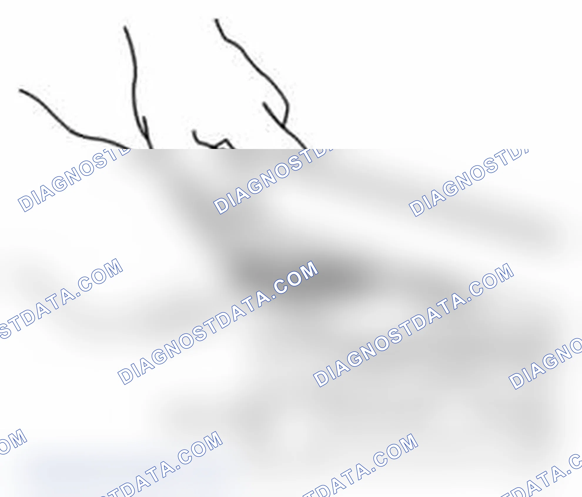 Scheme 209: Distortion of Gasket Surface