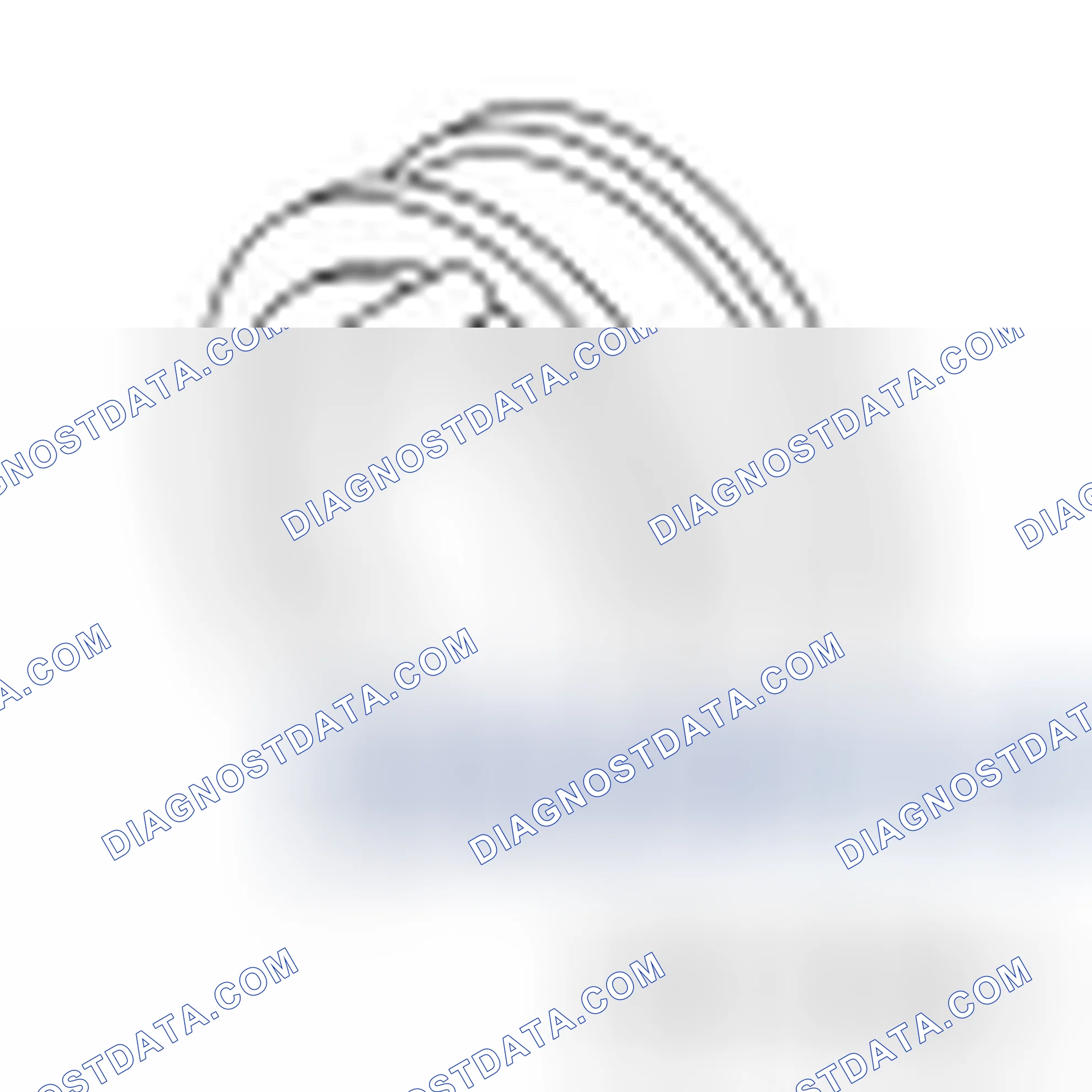 Scheme 15: Camshaft Timing
