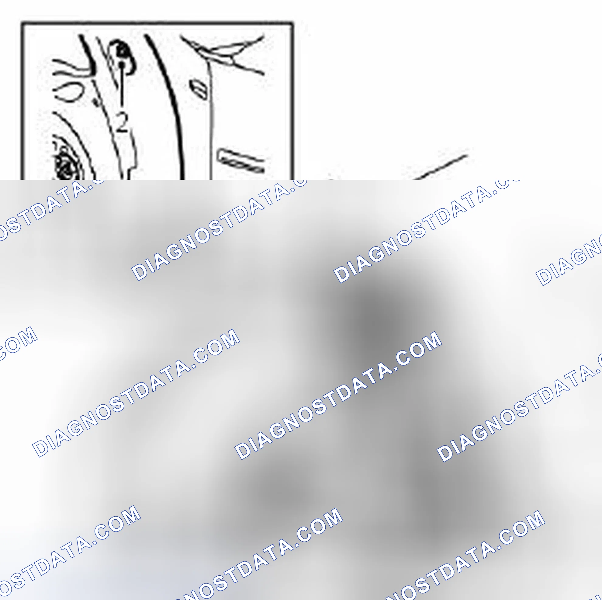 Scheme 243: To remove